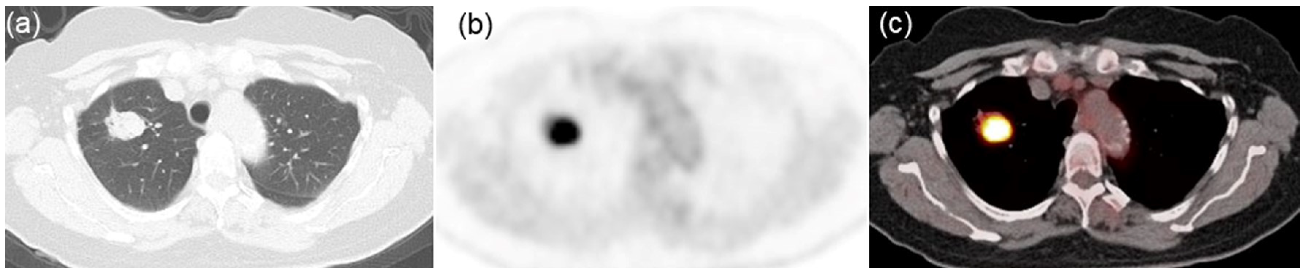 Jcm 13 01625 g002 Jcm 13 01625 g002
