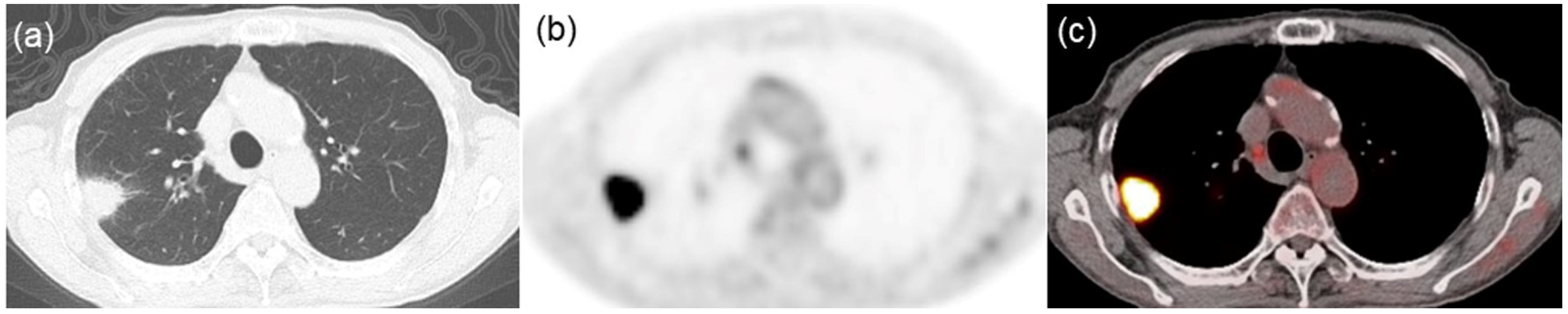 Jcm 13 01625 g003 Jcm 13 01625 g003