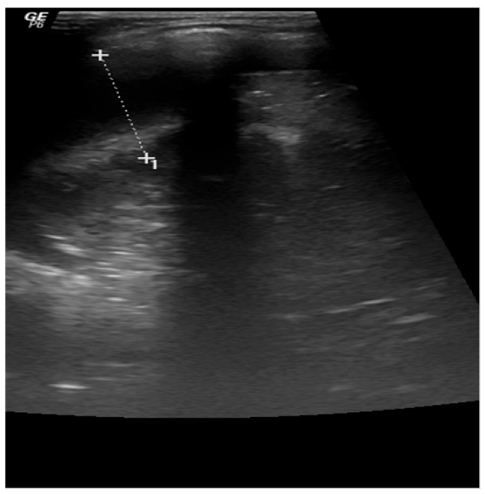 Jcm 13 01643 g004