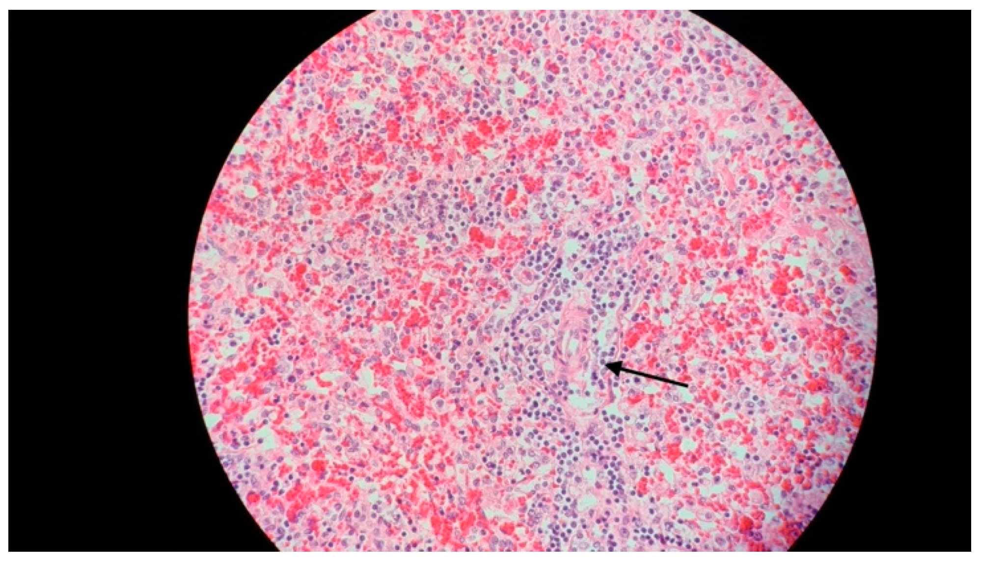 Jcm 13 01643 g005