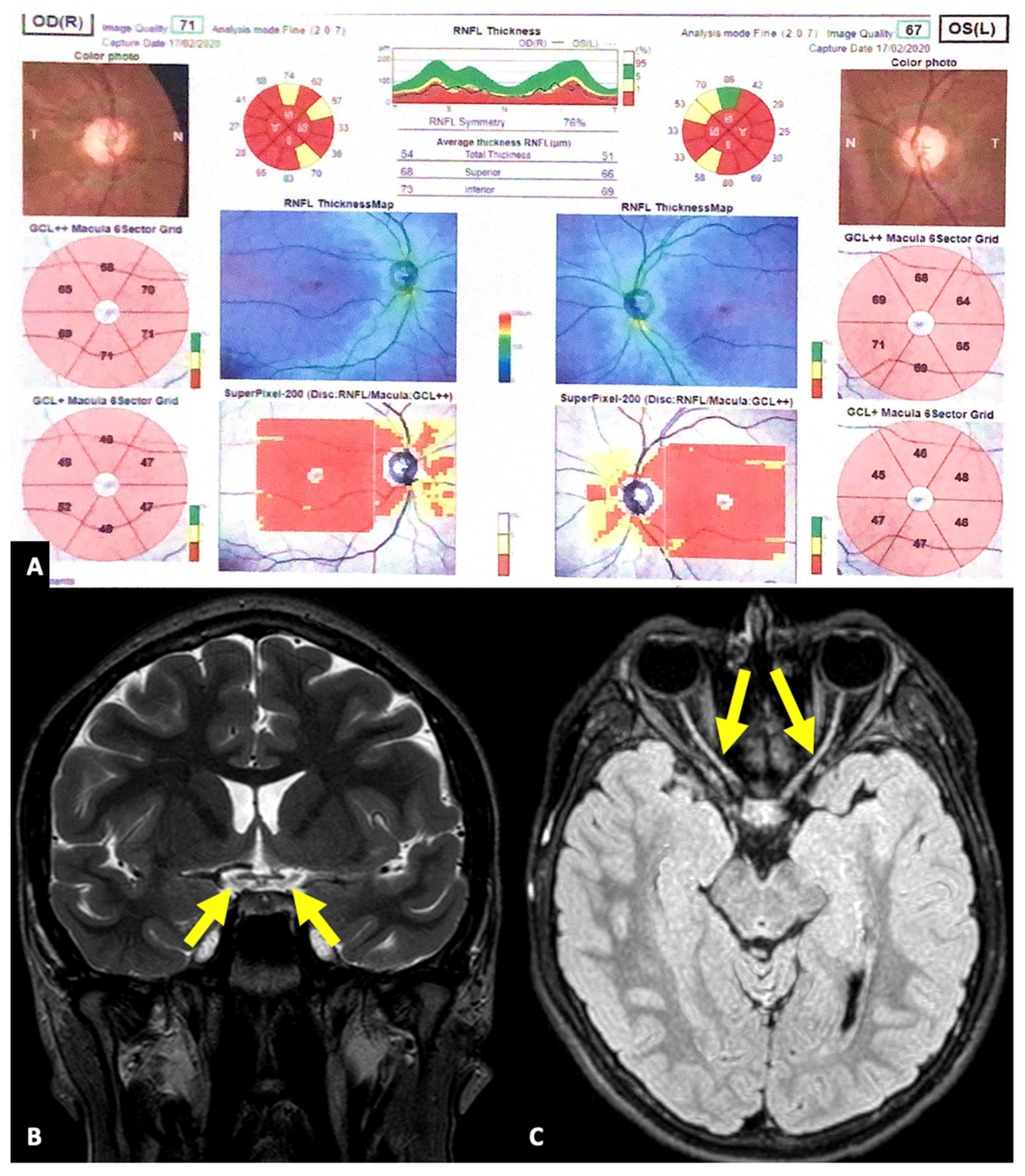Jcm 13 01803 g002 Jcm 13 01803 g002