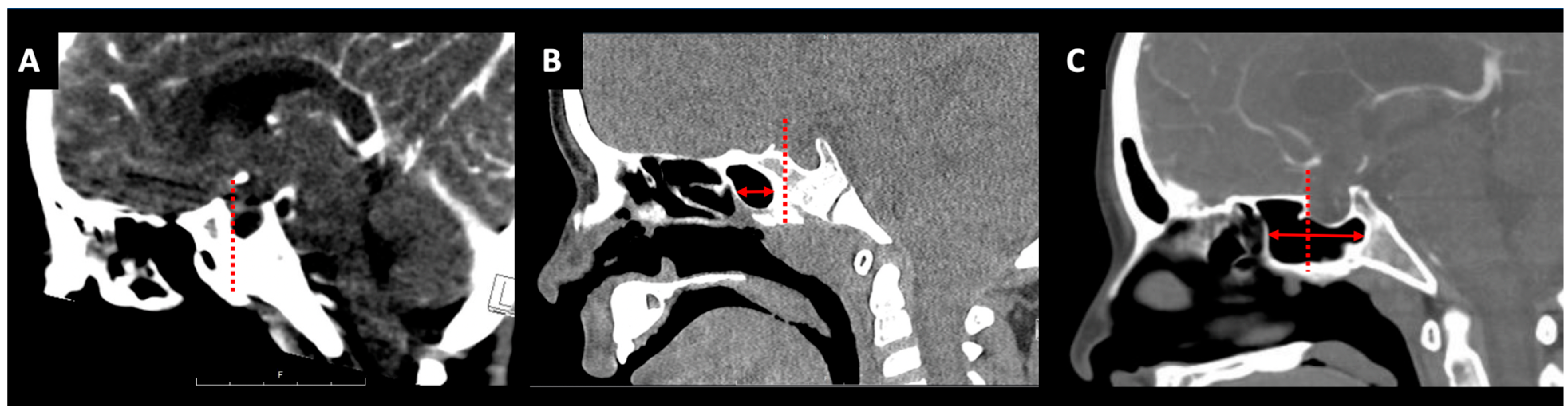 Jcm 13 01924 g001 Jcm 13 01924 g001