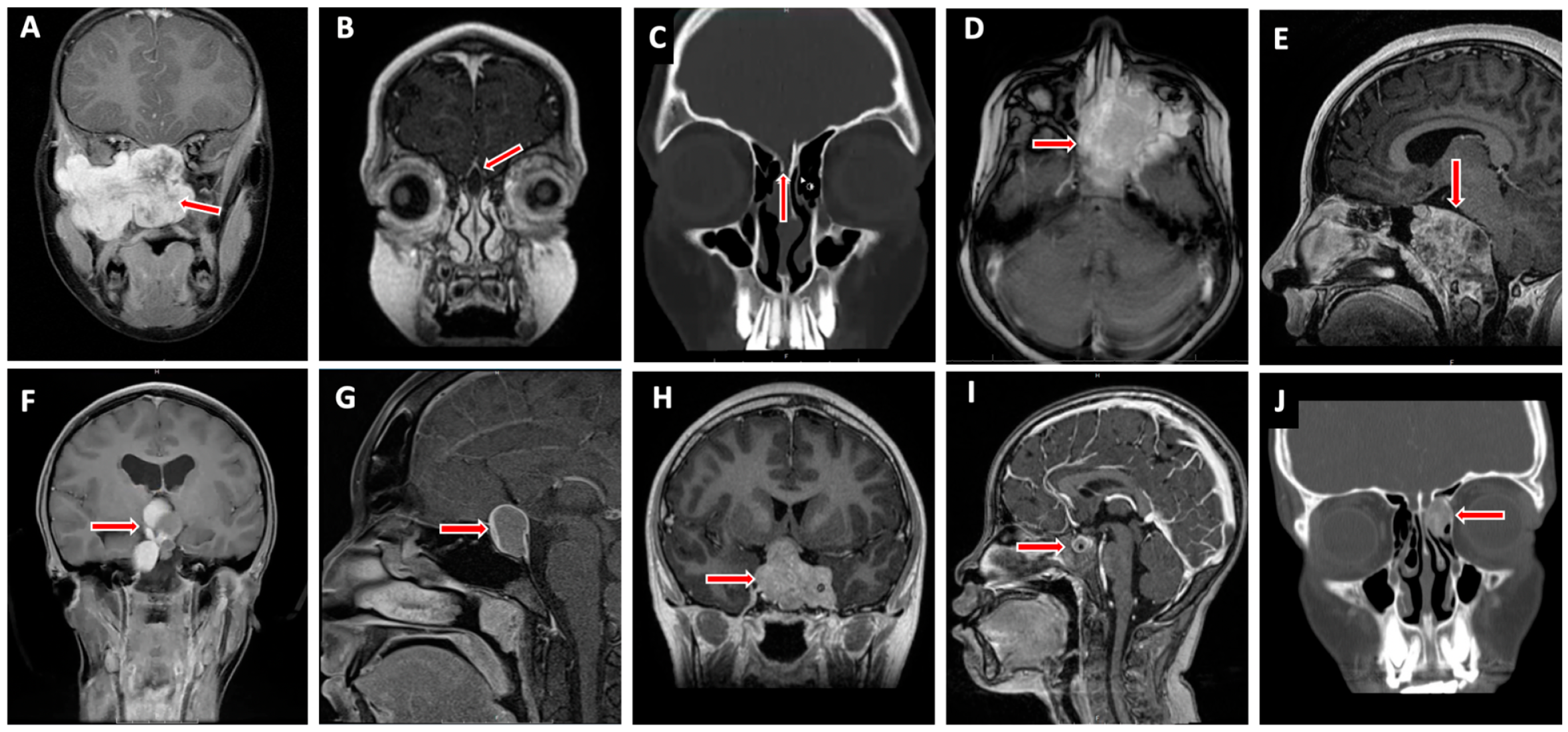 Jcm 13 01924 g002 Jcm 13 01924 g002