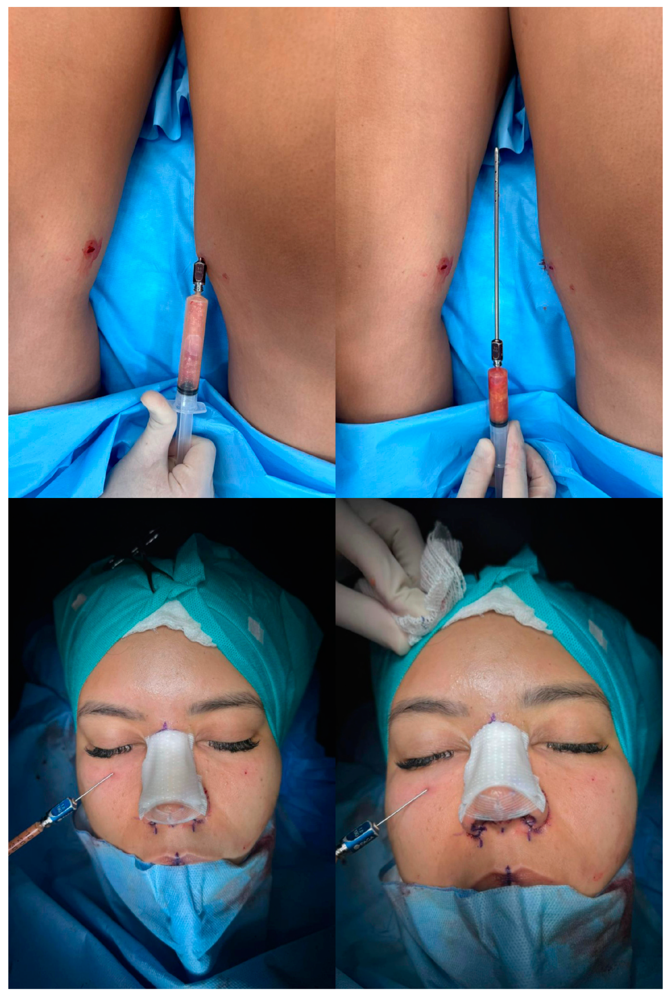 Jcm 13 01965 g002 Jcm 13 01965 g002