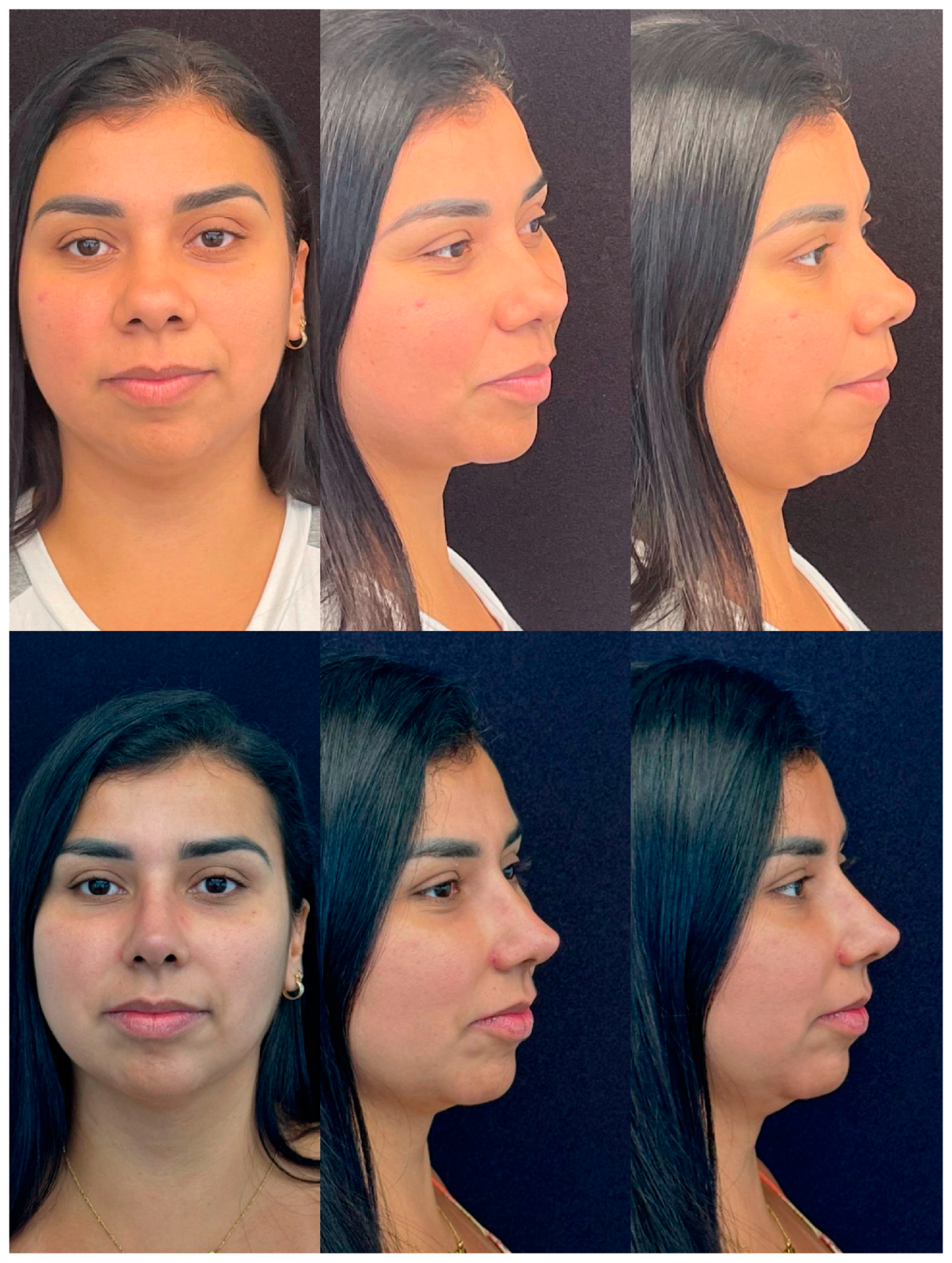 Jcm 13 01965 g003 Jcm 13 01965 g003