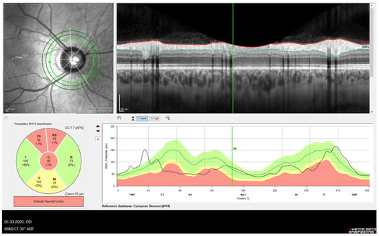 JCM | Free Full-Text | Current Status and Future Perspectives of Optic ...