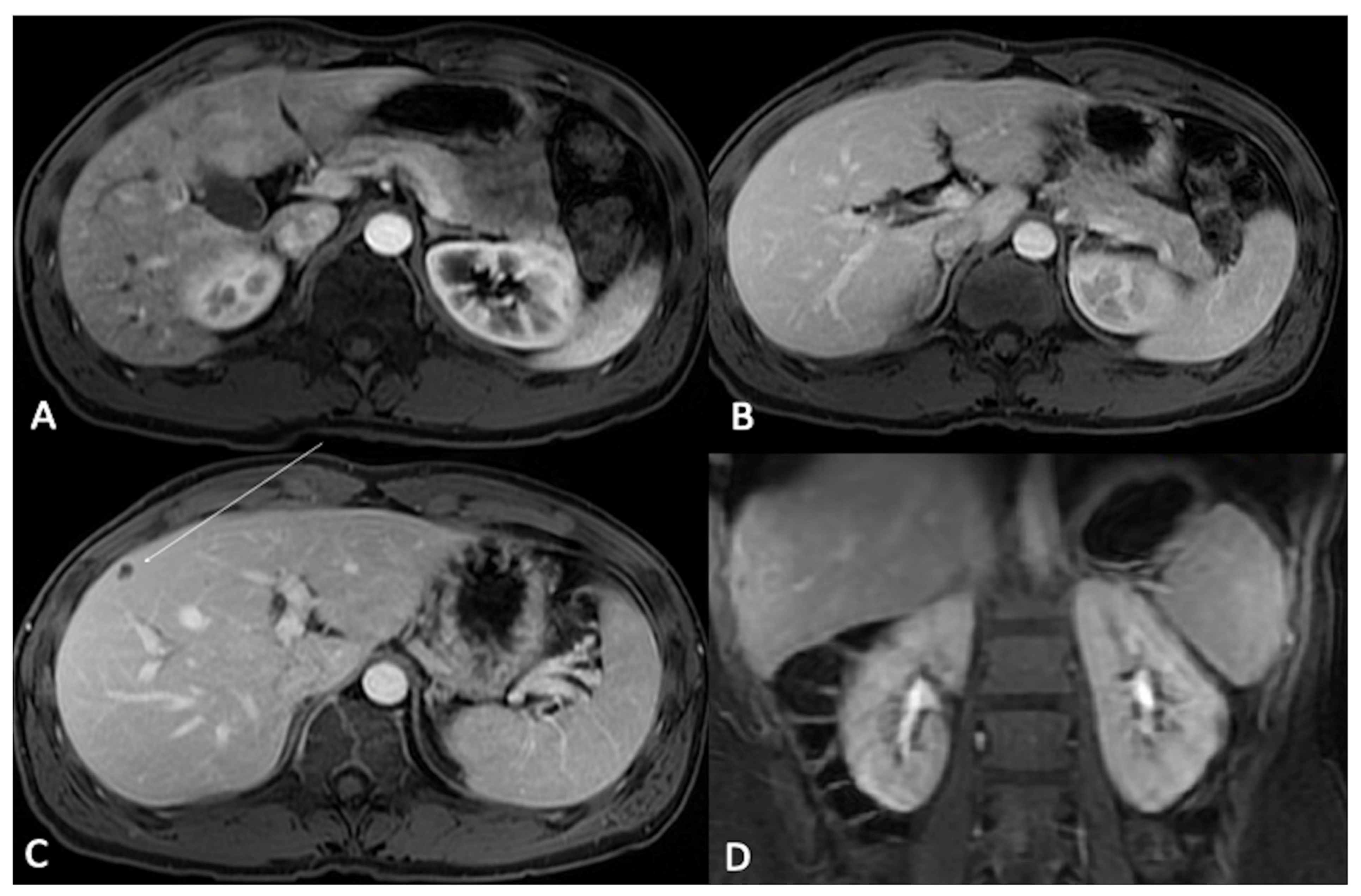 Jcm 13 02193 g004 Jcm 13 02193 g004