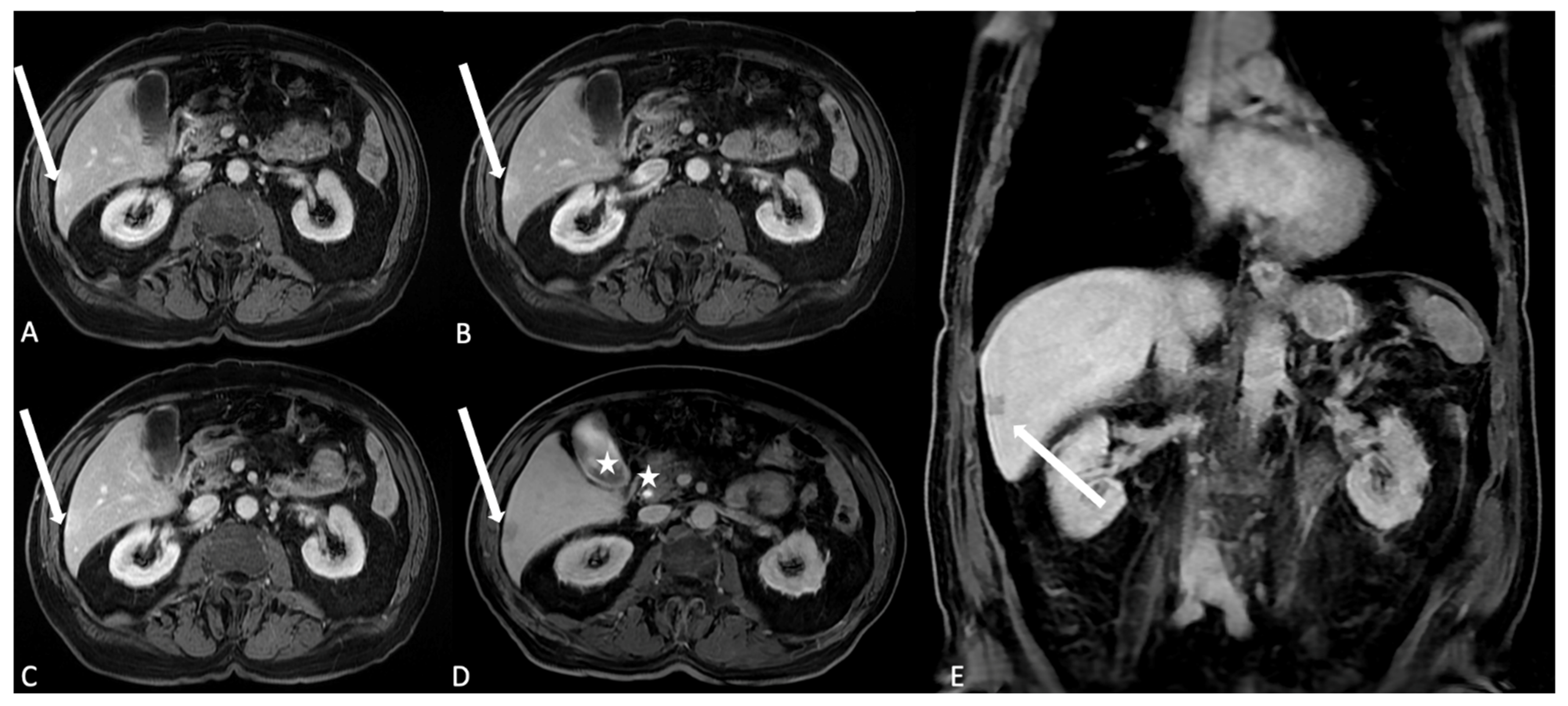Jcm 13 02193 g005 Jcm 13 02193 g005