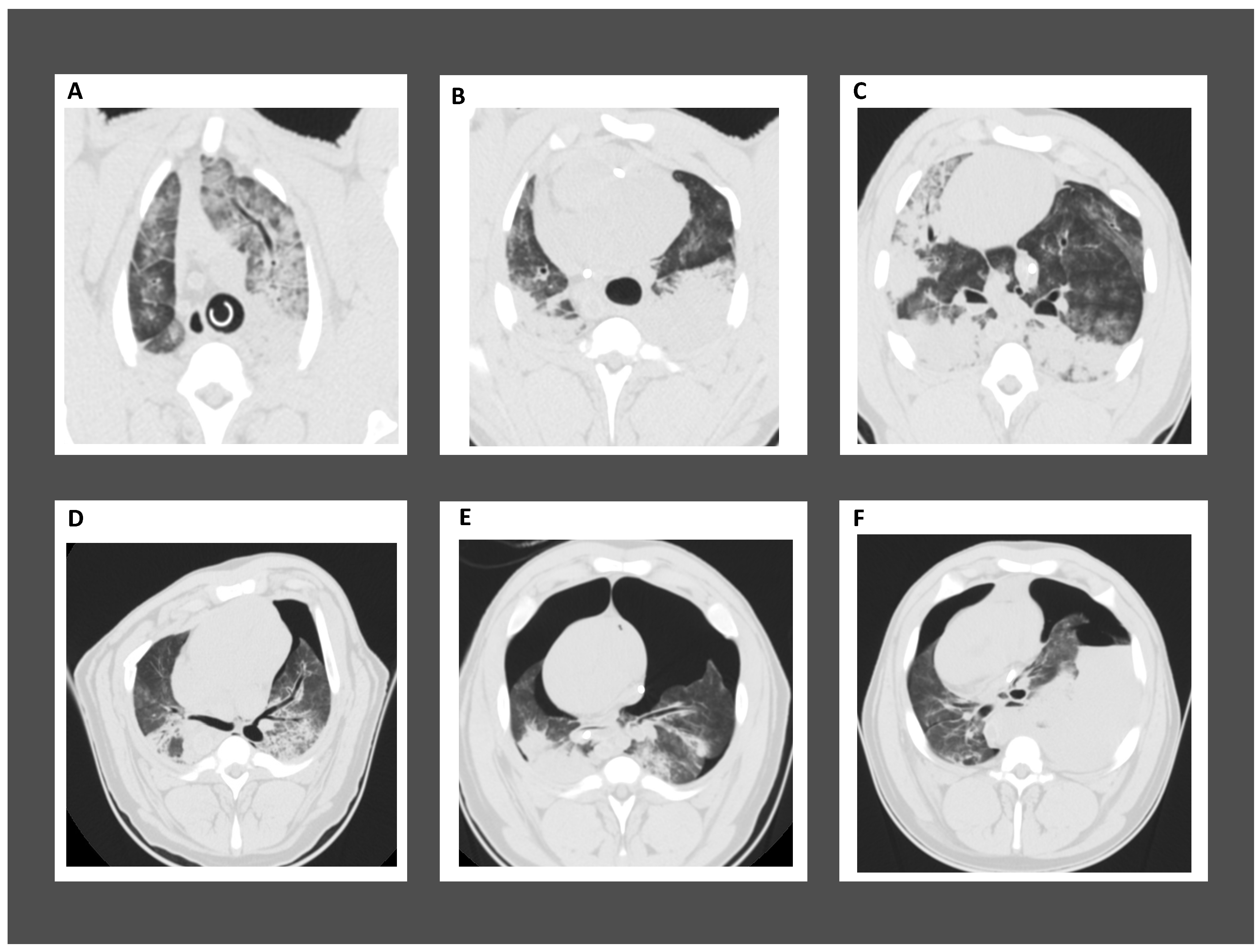 JCM | Free Full-Text | Acute Lung Injury after Cardiopulmonary ...