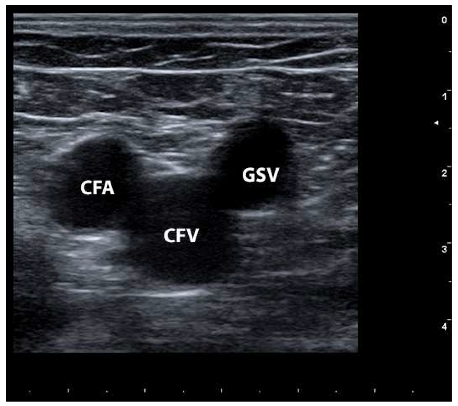 Jcm 13 02539 g002 Jcm 13 02539 g002