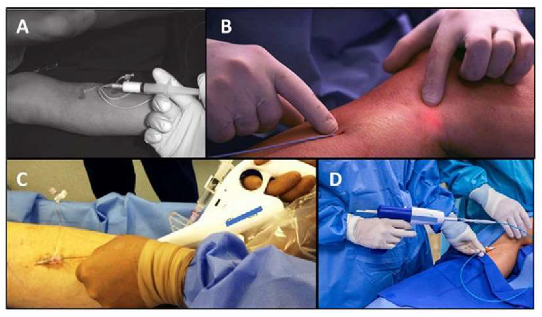 Jcm 13 02539 g005 Jcm 13 02539 g005