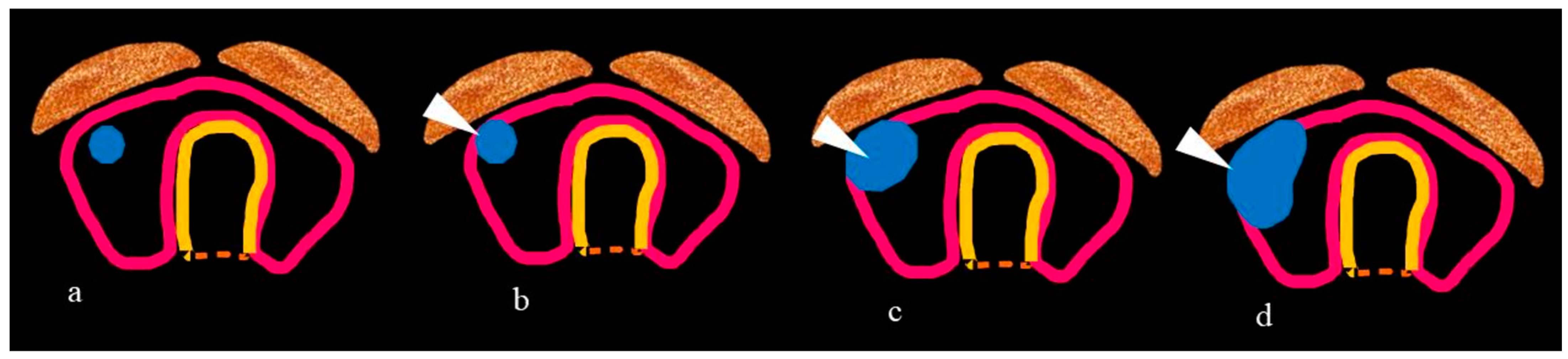 Jcm 13 02904 g002 Jcm 13 02904 g002