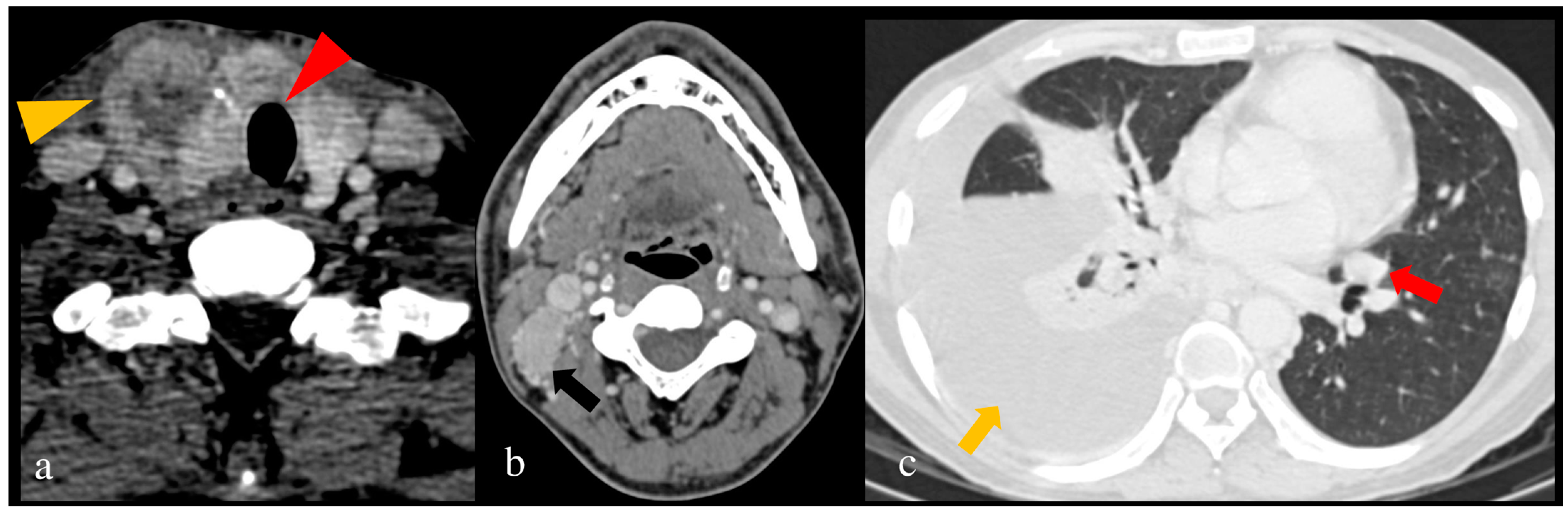 Jcm 13 02904 g004 Jcm 13 02904 g004