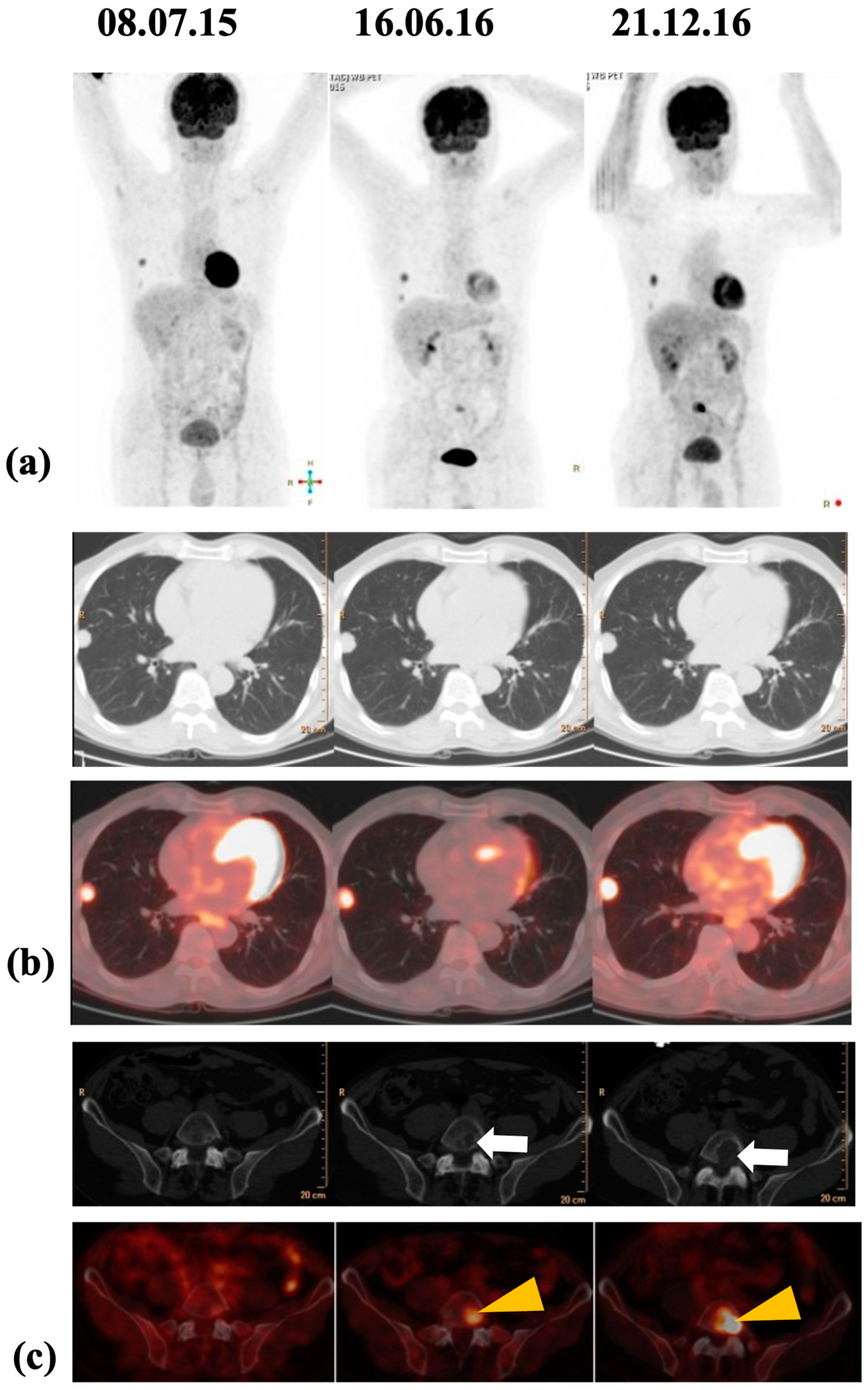 Jcm 13 02904 g007 Jcm 13 02904 g007
