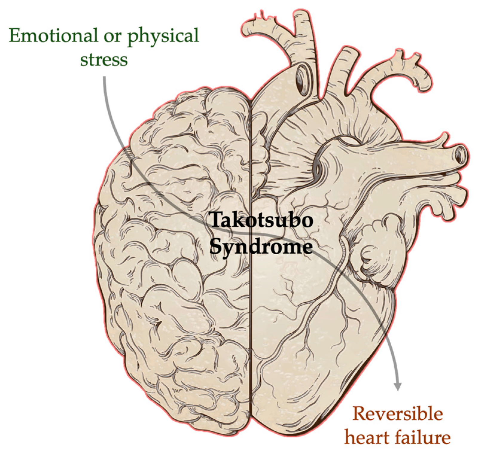 Combined Brain–Heart Imaging in Takotsubo Syndrome: Towards a Holistic ...