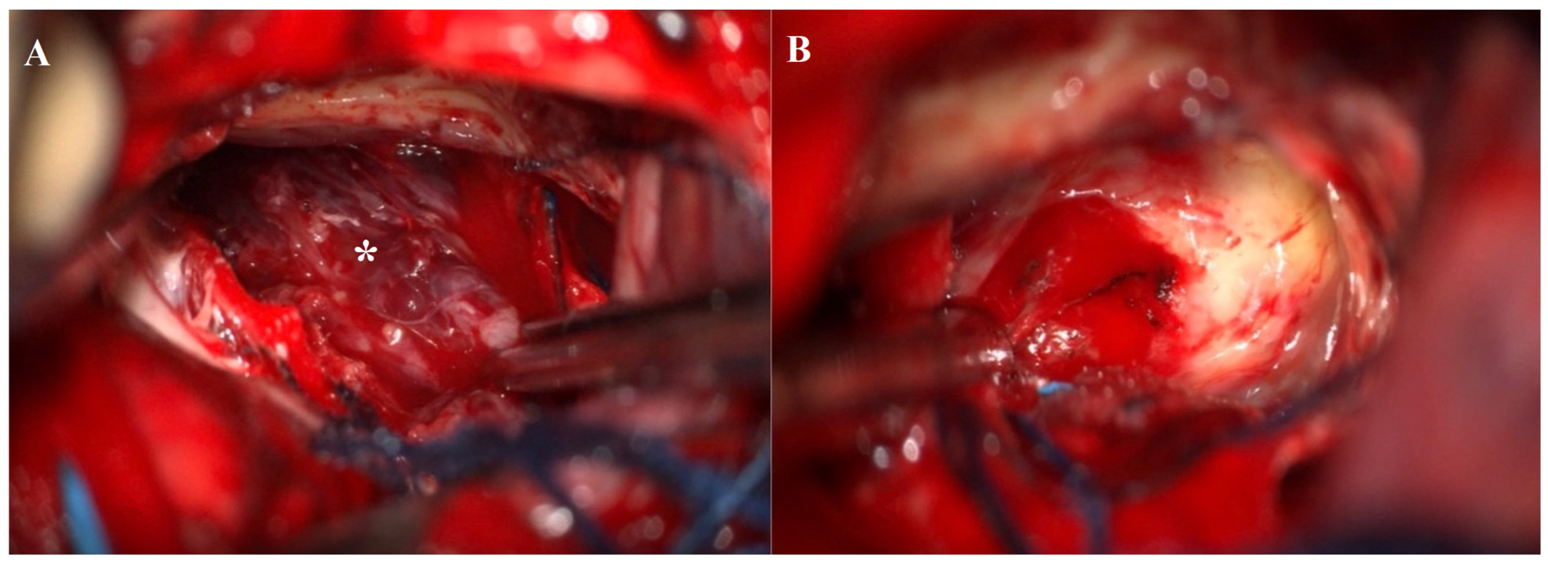 Jcm 13 03536 g007 Jcm 13 03536 g007
