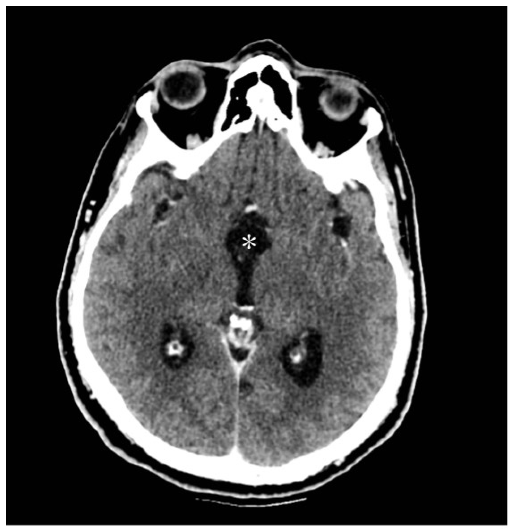 Jcm 13 03536 g008 Jcm 13 03536 g008
