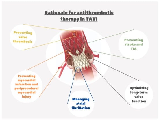 JCM | Free Full-Text | Antithrombotic Therapy in Patients Undergoing ...