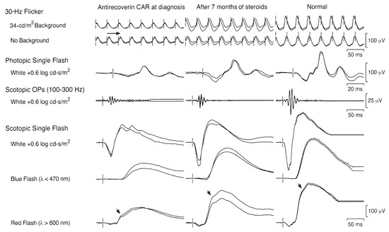 JCM | Free Full-Text | Application of Ophthalmic Electrophysiology in ...