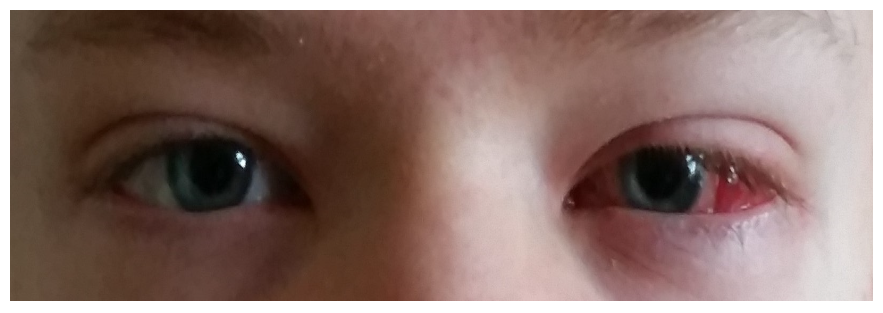 Jcm 13 04041 g002 Jcm 13 04041 g002