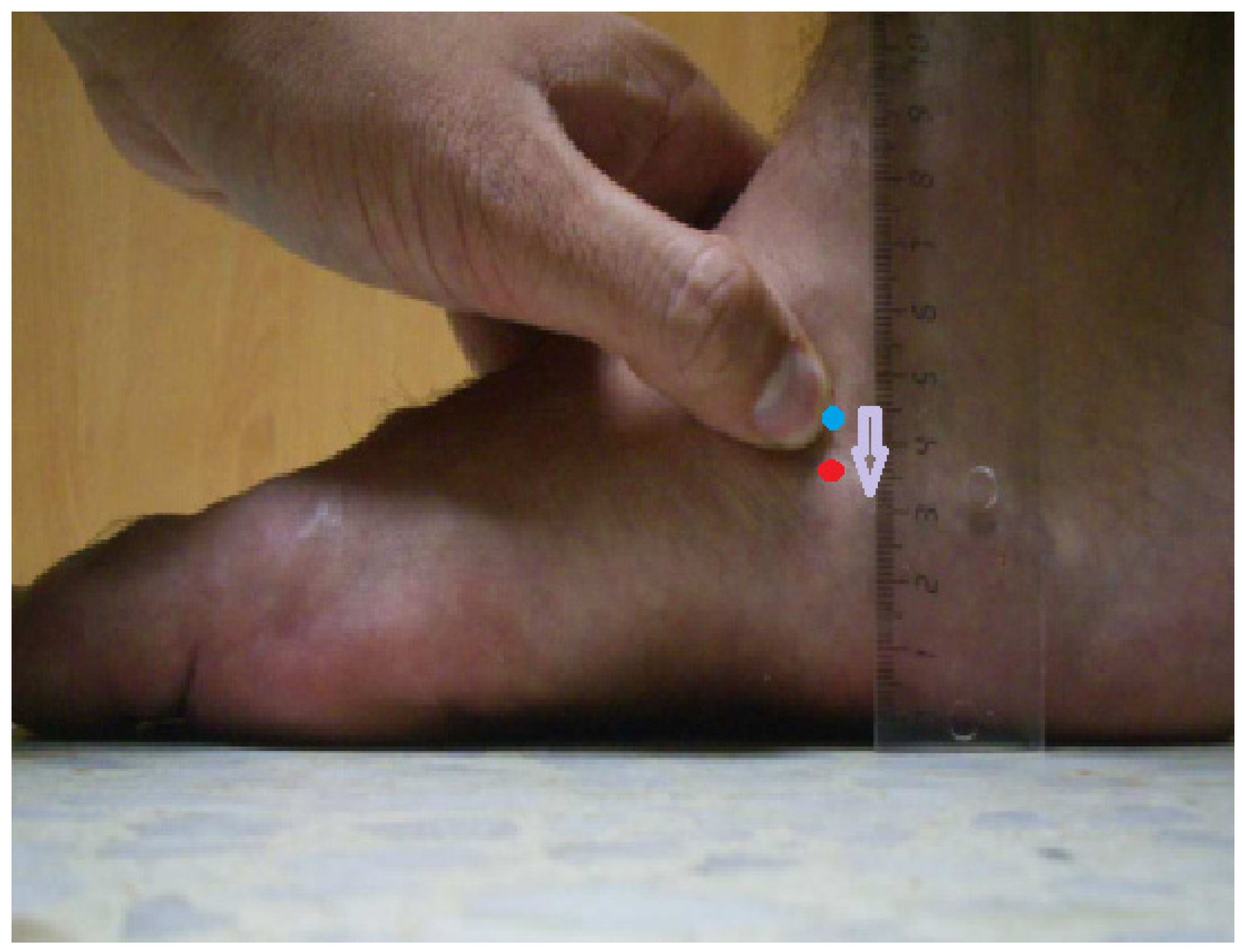 Jcm 13 04049 g001 Jcm 13 04049 g001