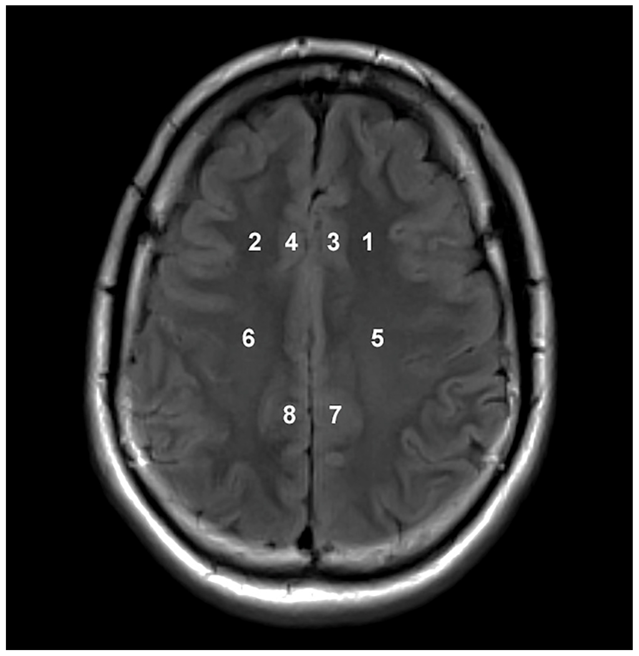 Jcm 13 04128 g001 Jcm 13 04128 g001