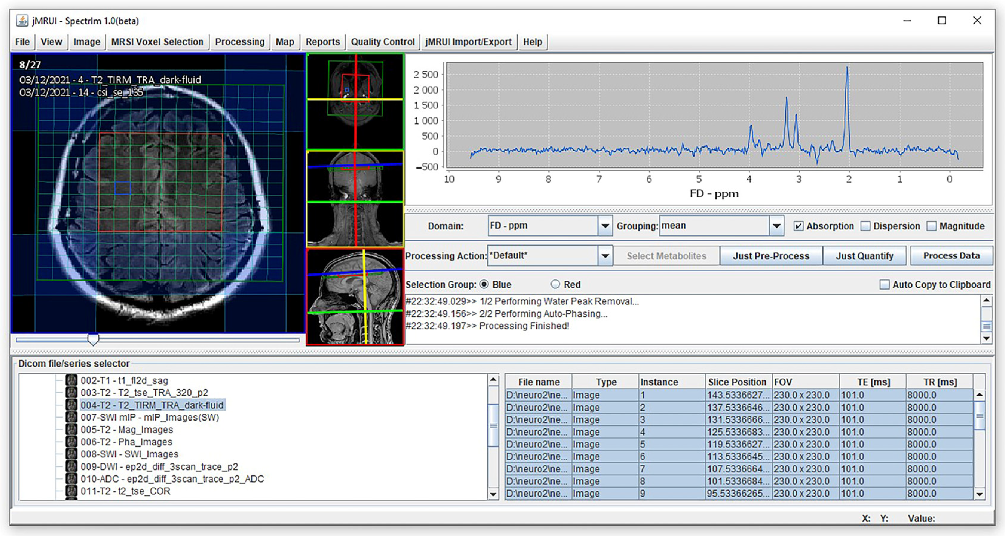 Jcm 13 04128 g002 Jcm 13 04128 g002