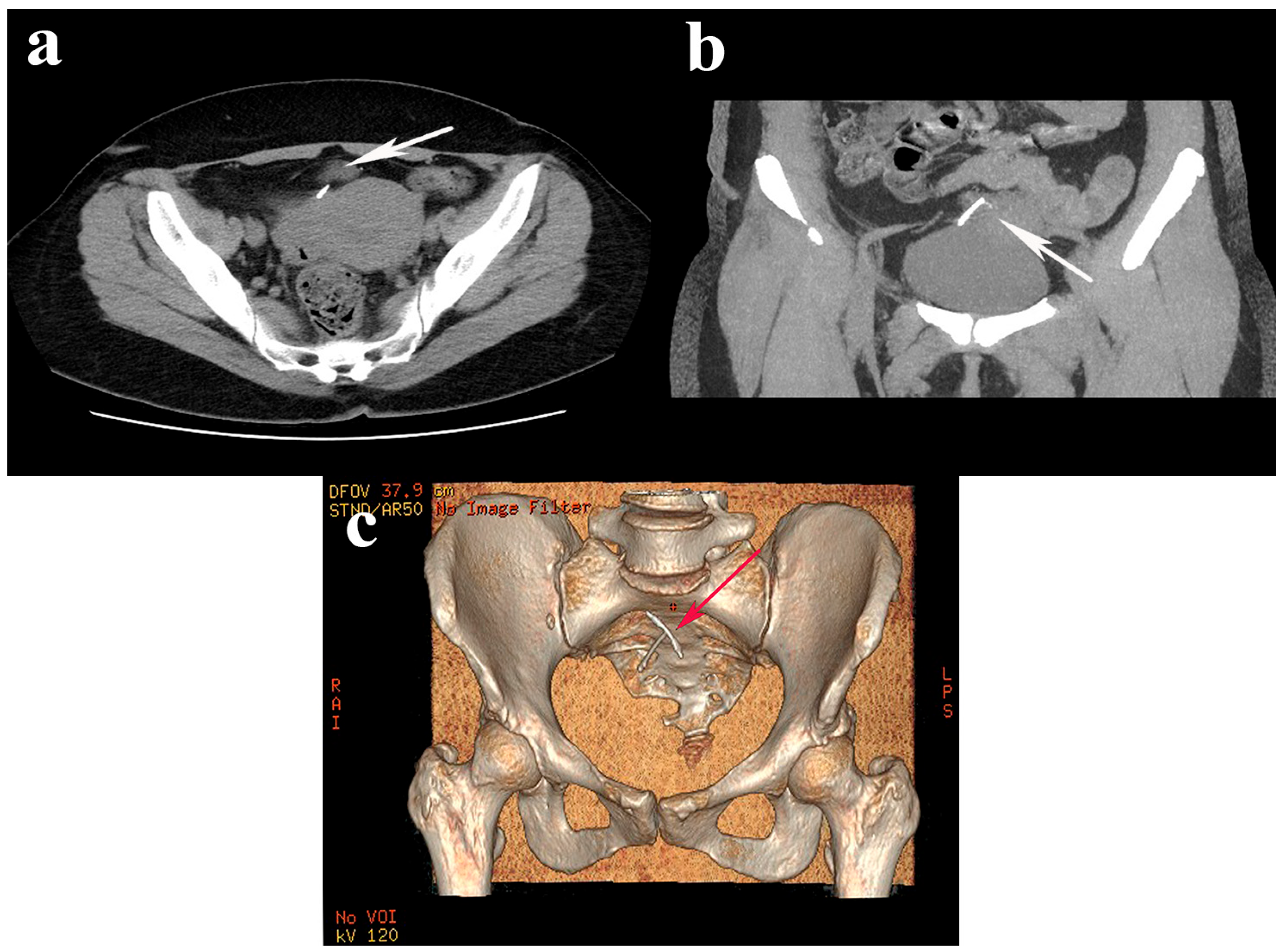 Jcm 13 04233 g001 Jcm 13 04233 g001