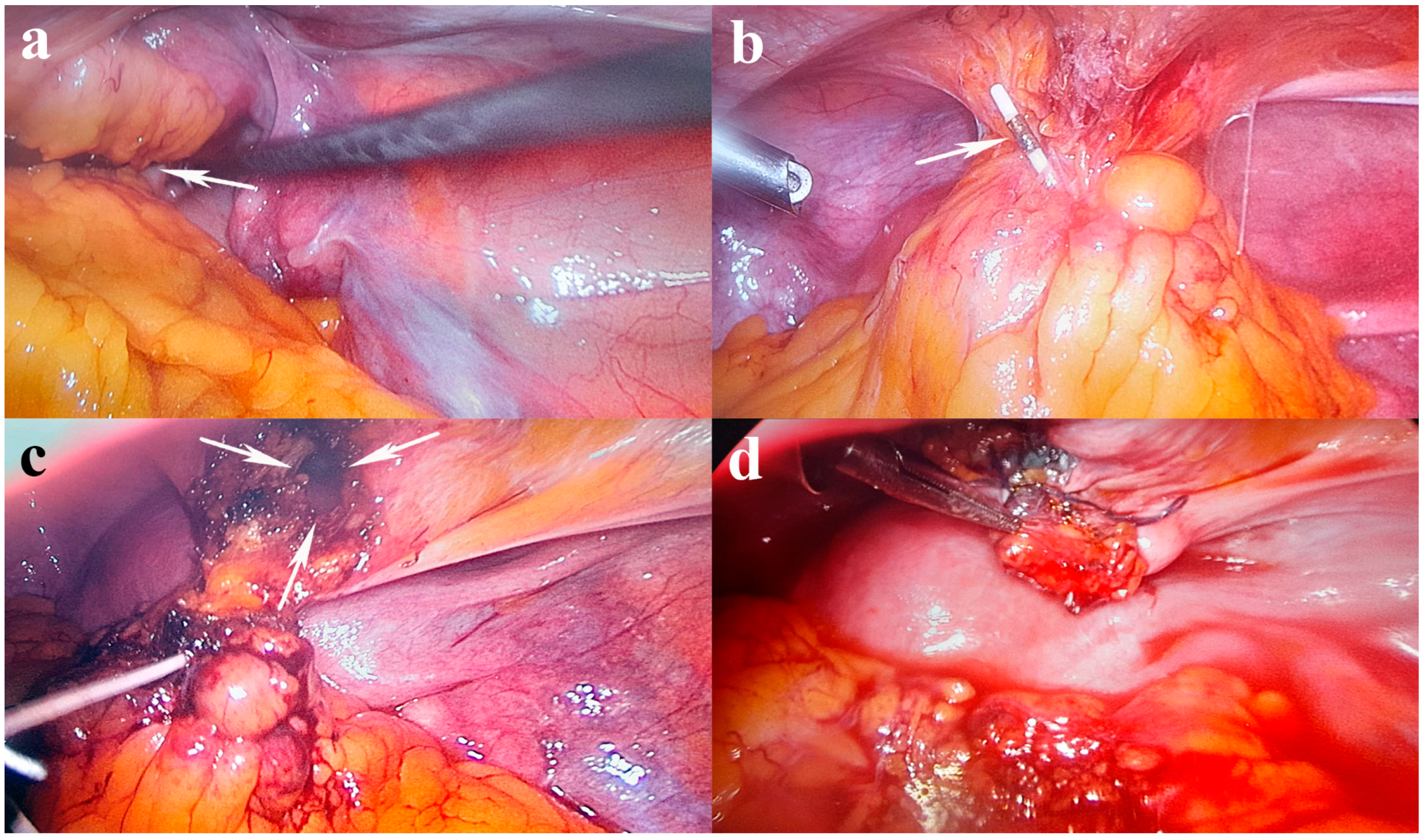 Jcm 13 04233 g002 Jcm 13 04233 g002