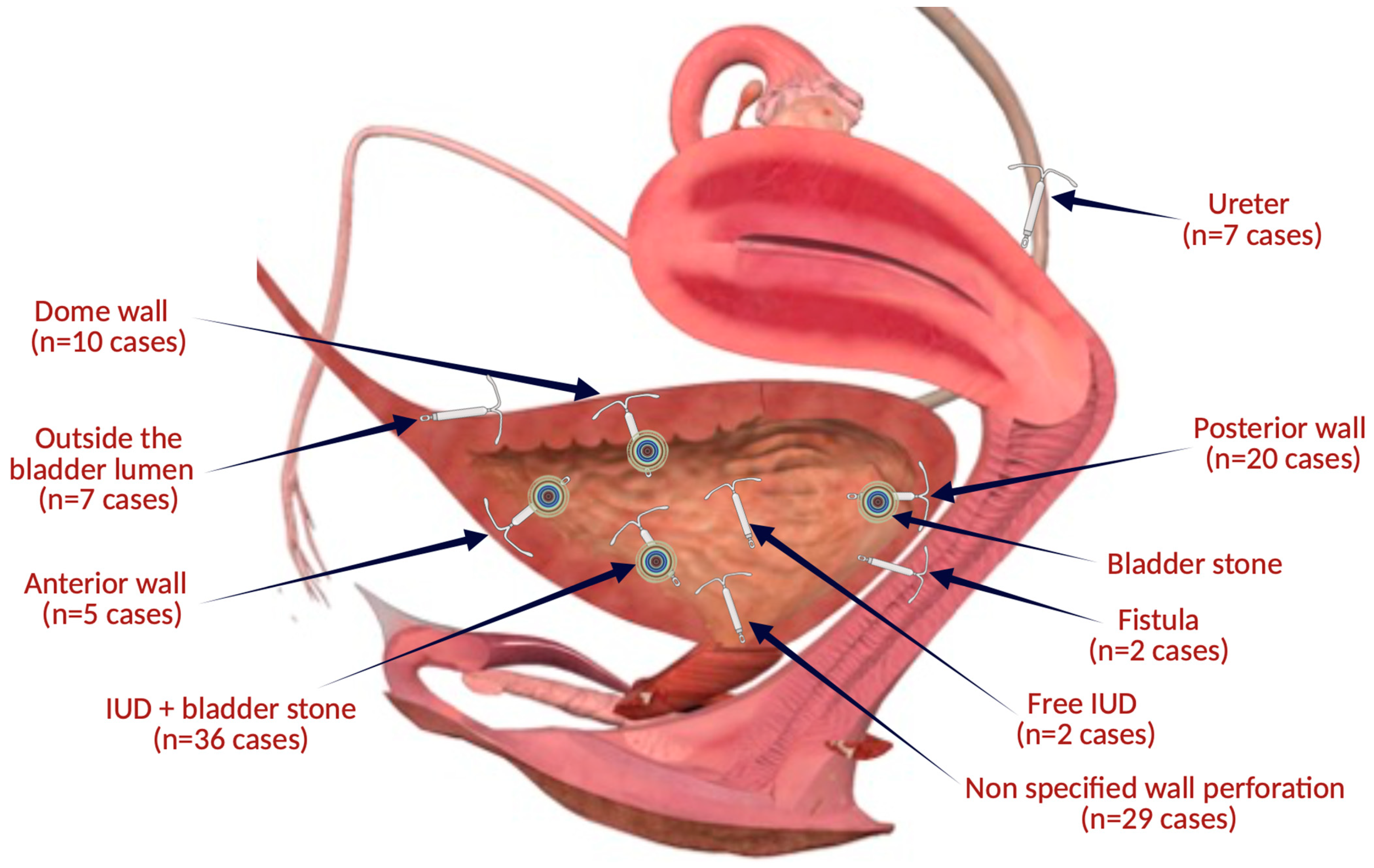 Jcm 13 04233 g004 Jcm 13 04233 g004
