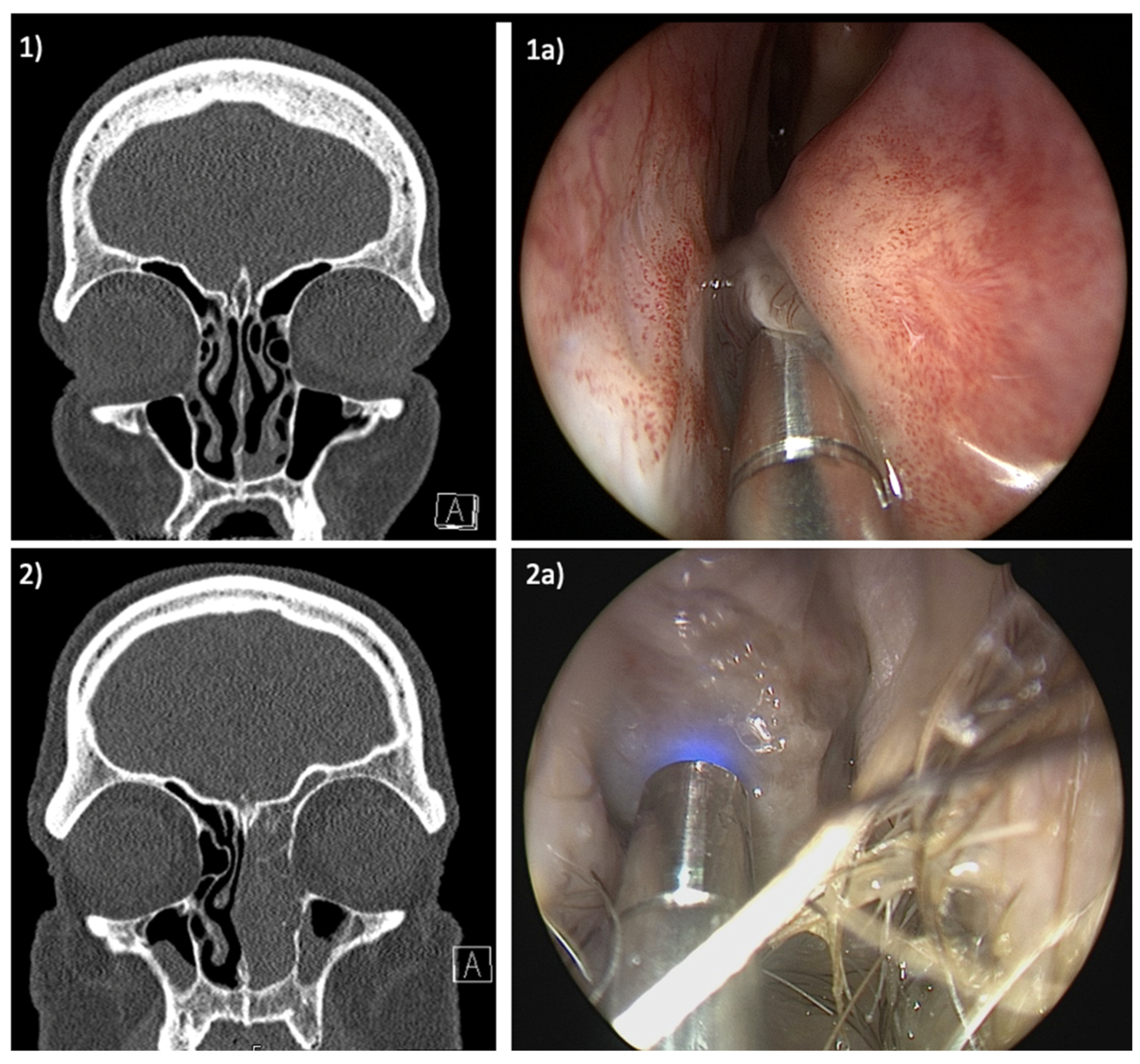 Jcm 13 04483 g002 Jcm 13 04483 g002