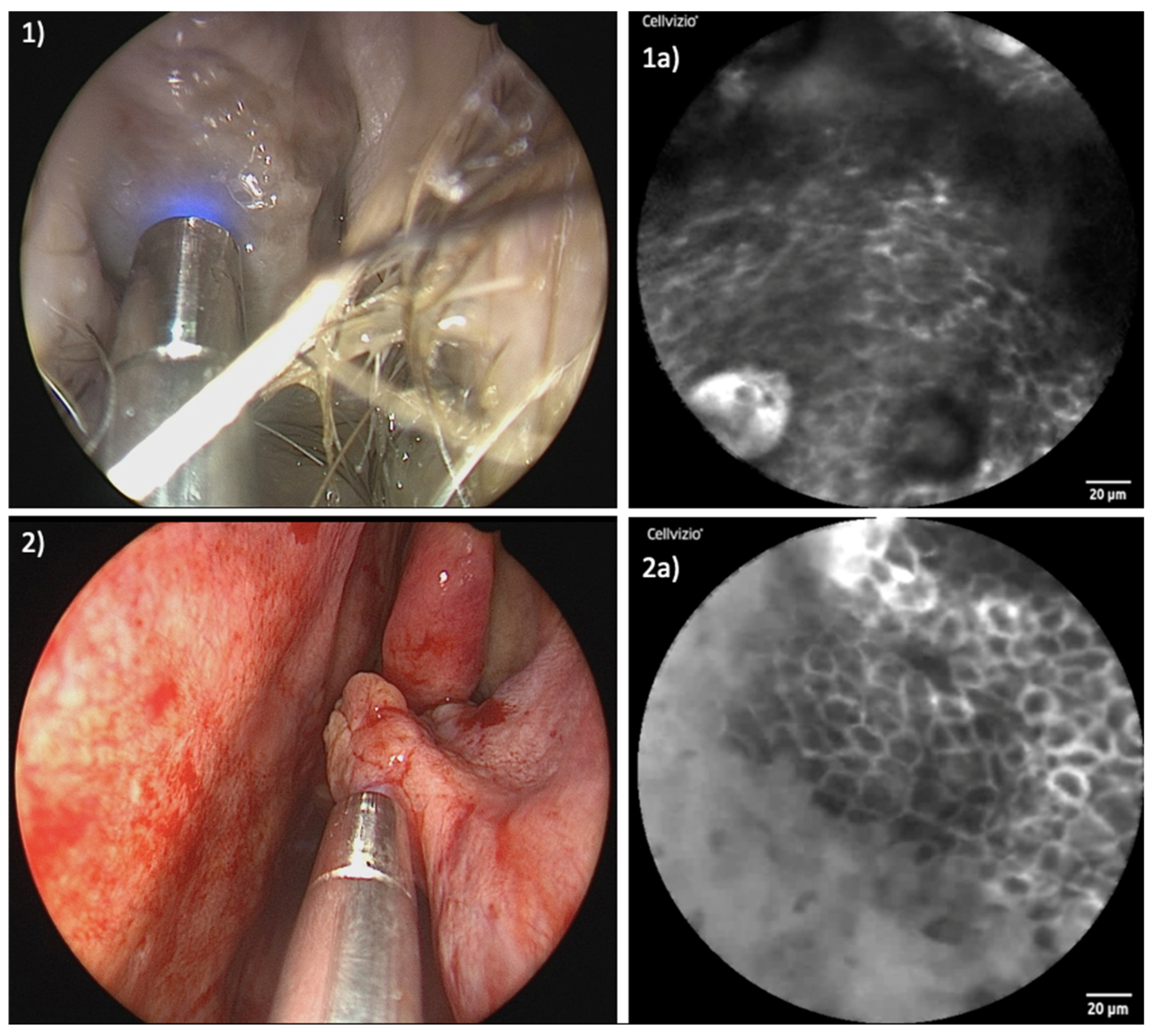 Jcm 13 04483 g003 Jcm 13 04483 g003