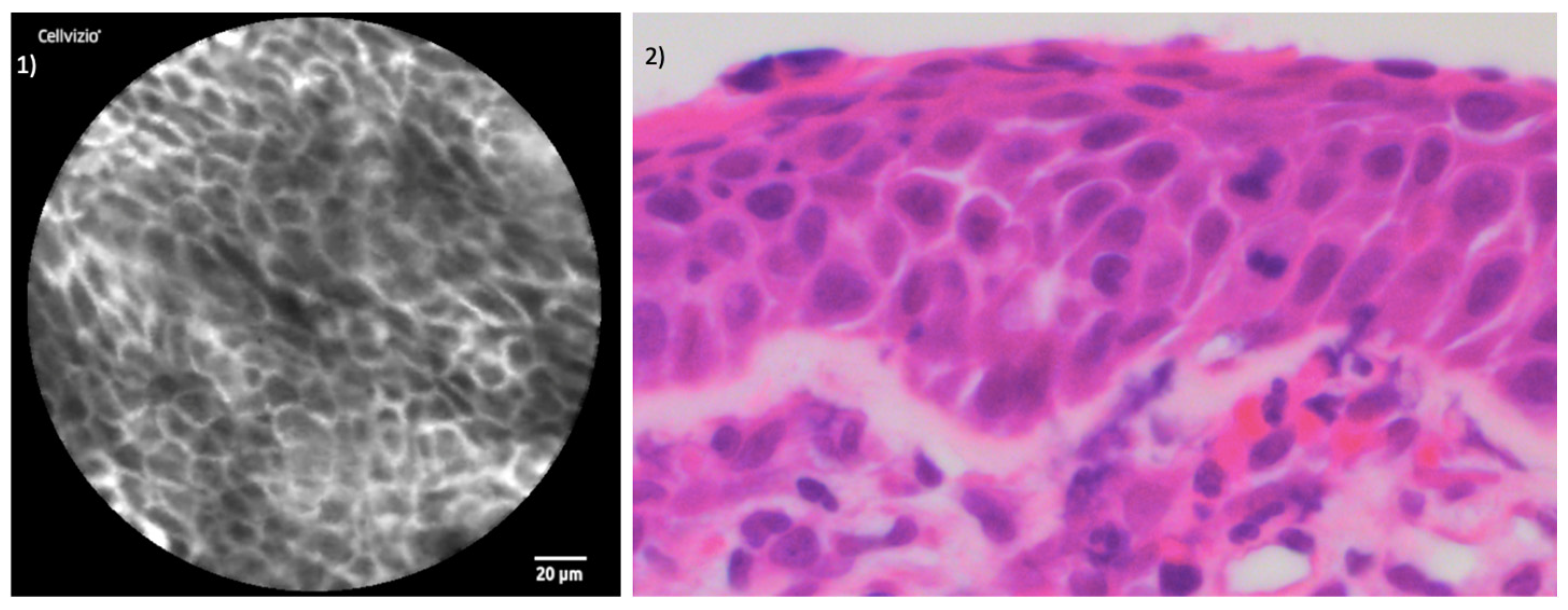 Jcm 13 04483 g005 Jcm 13 04483 g005
