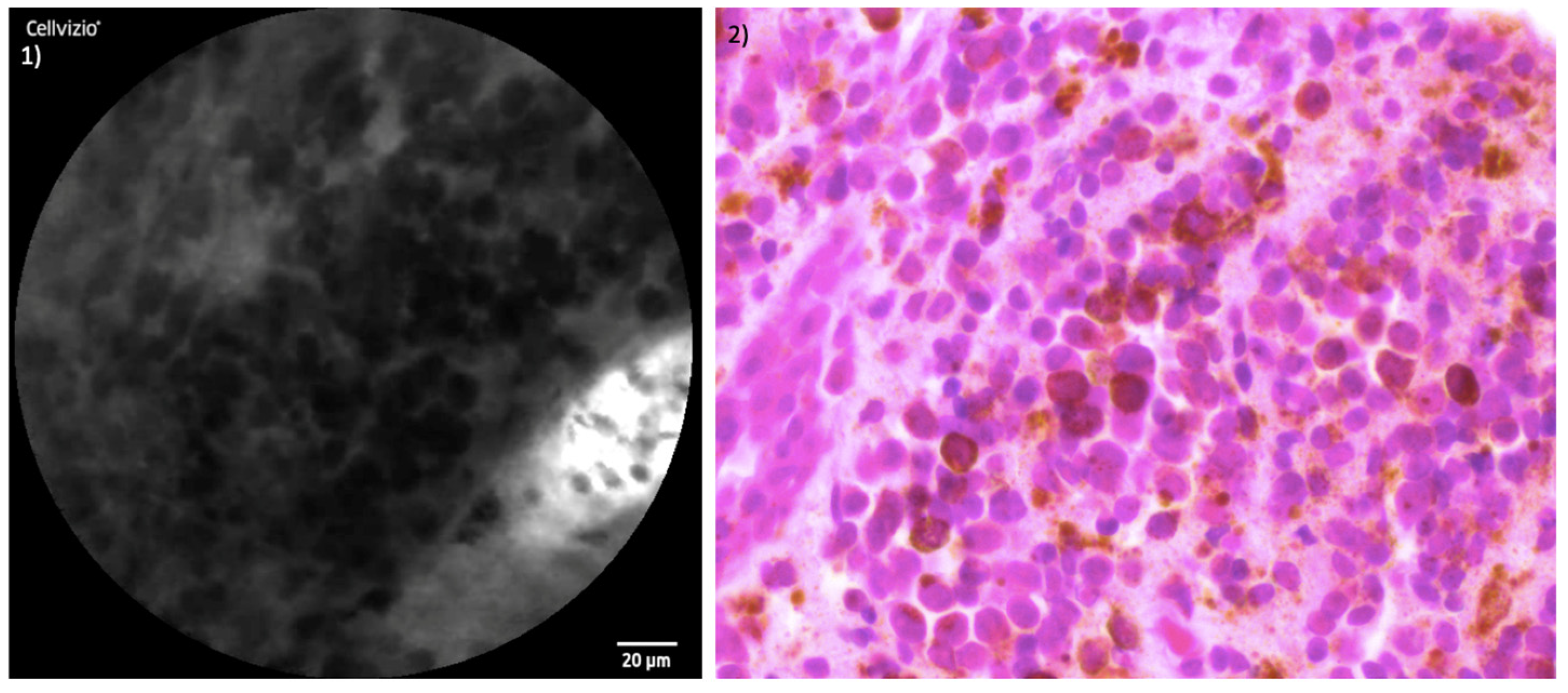 Jcm 13 04483 g006 Jcm 13 04483 g006