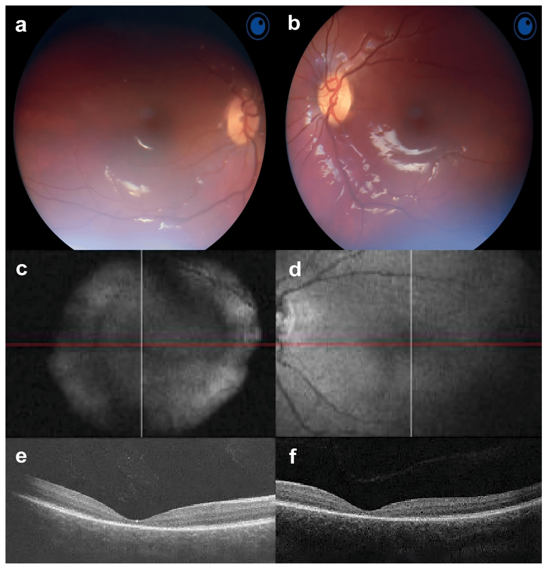 Jcm 13 04592 g001 Jcm 13 04592 g001