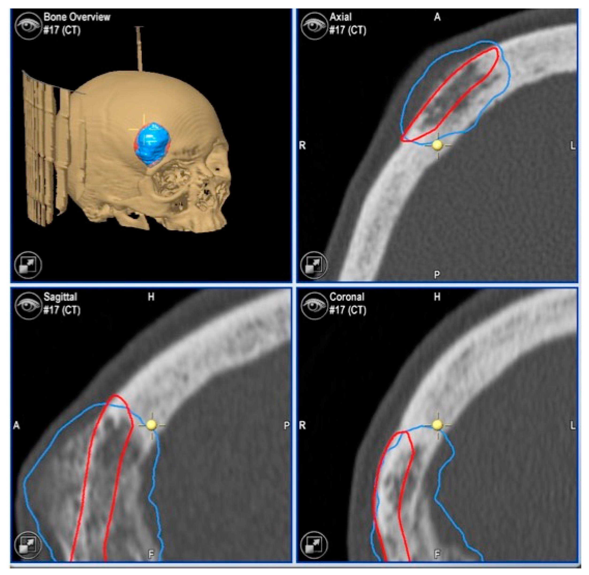Jcm 13 04602 g005 Jcm 13 04602 g005