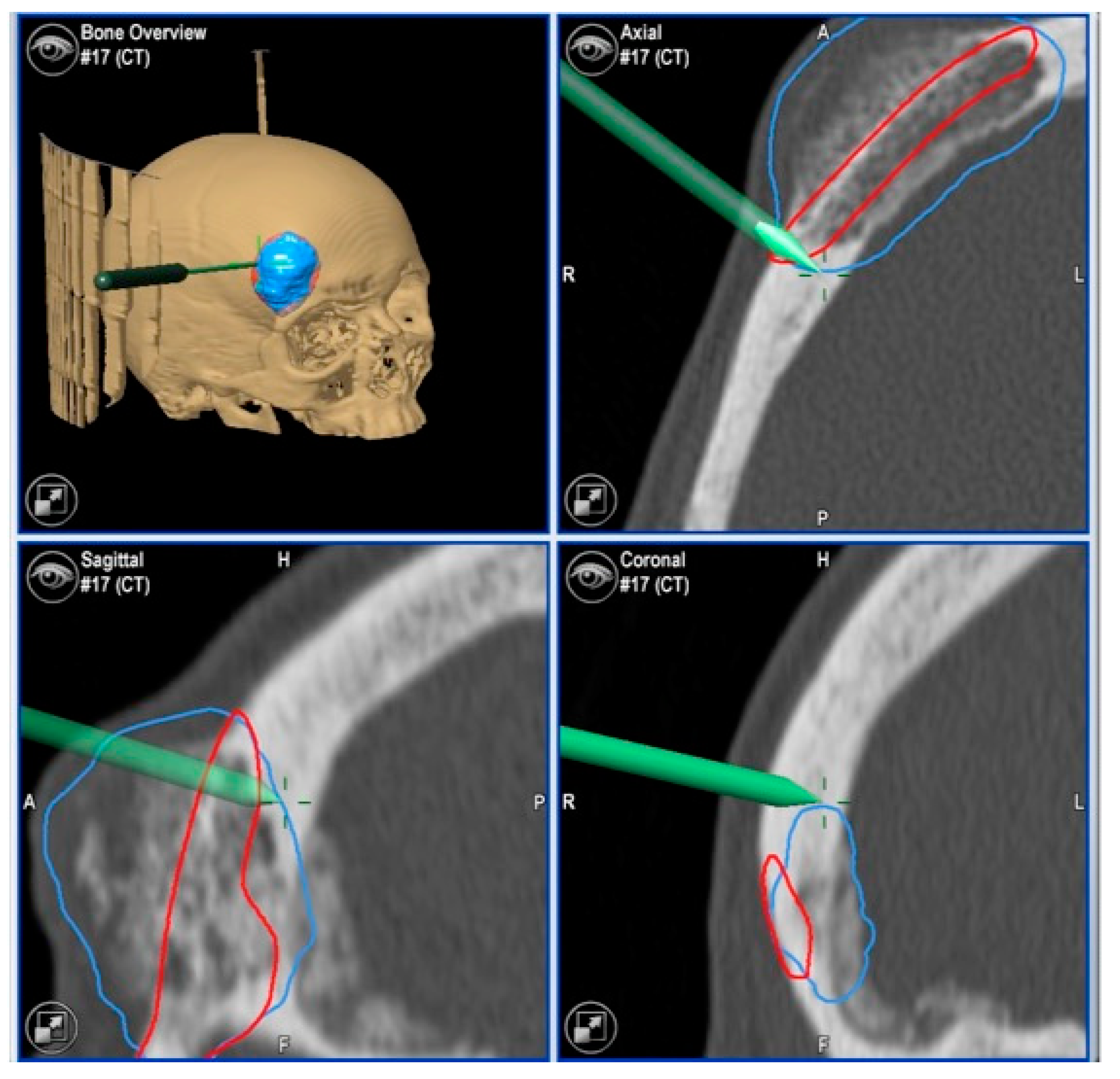 Jcm 13 04602 g006 Jcm 13 04602 g006