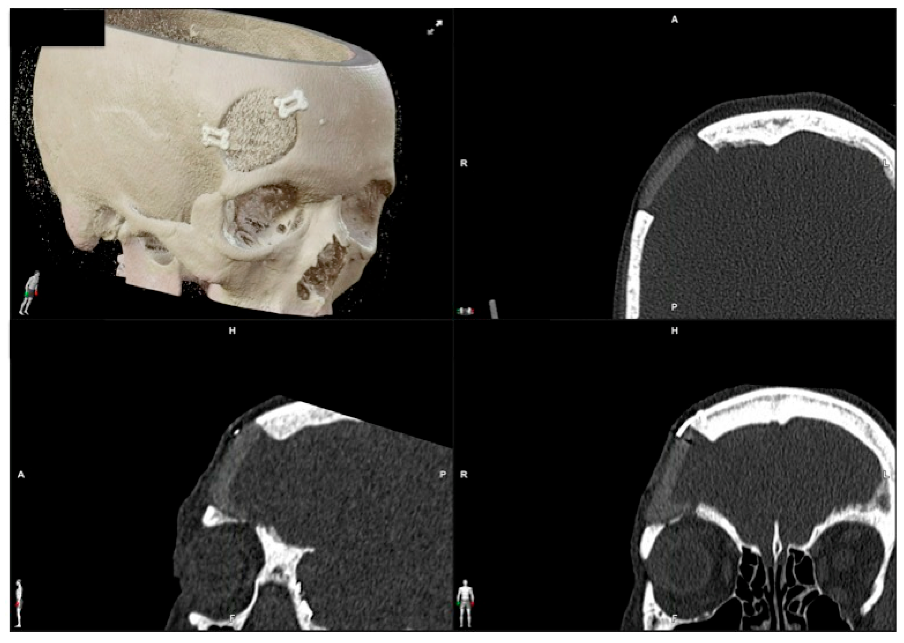 Jcm 13 04602 g008 Jcm 13 04602 g008
