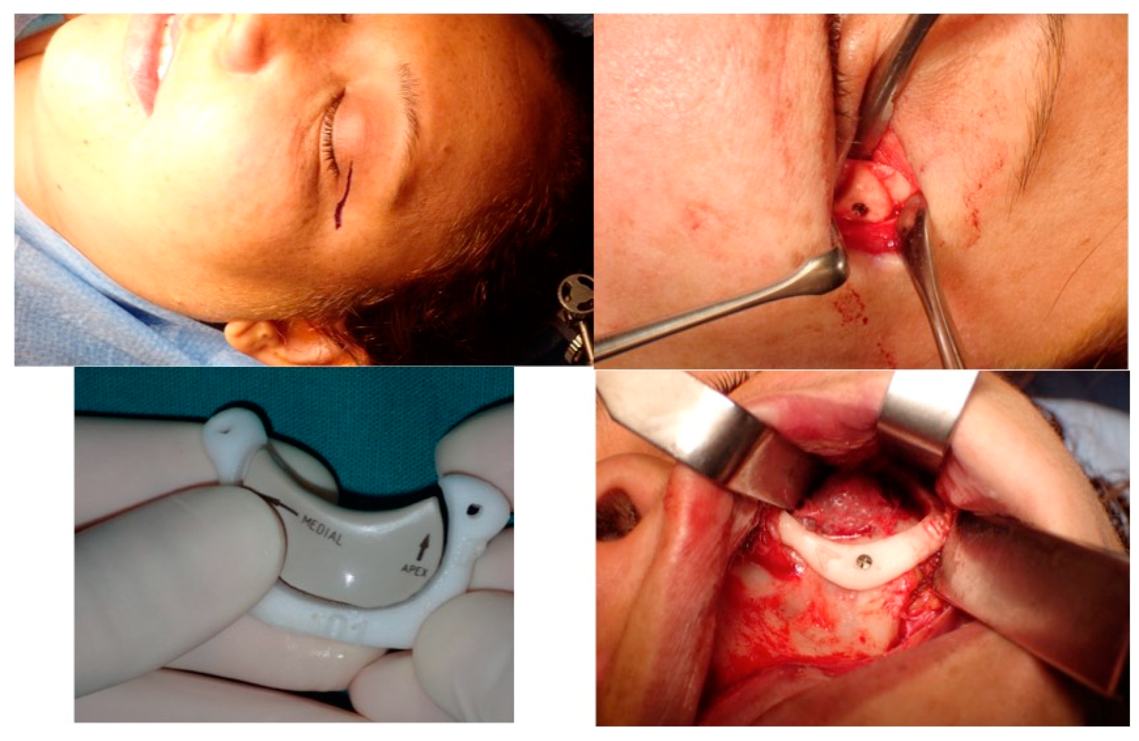 Jcm 13 04602 g014 Jcm 13 04602 g014