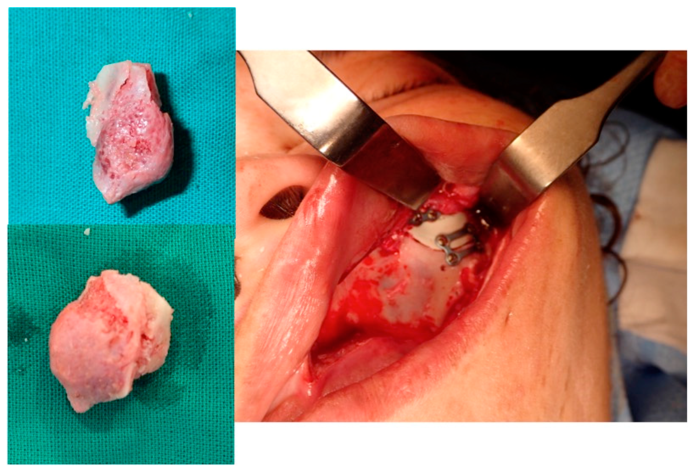 Jcm 13 04602 g016 Jcm 13 04602 g016