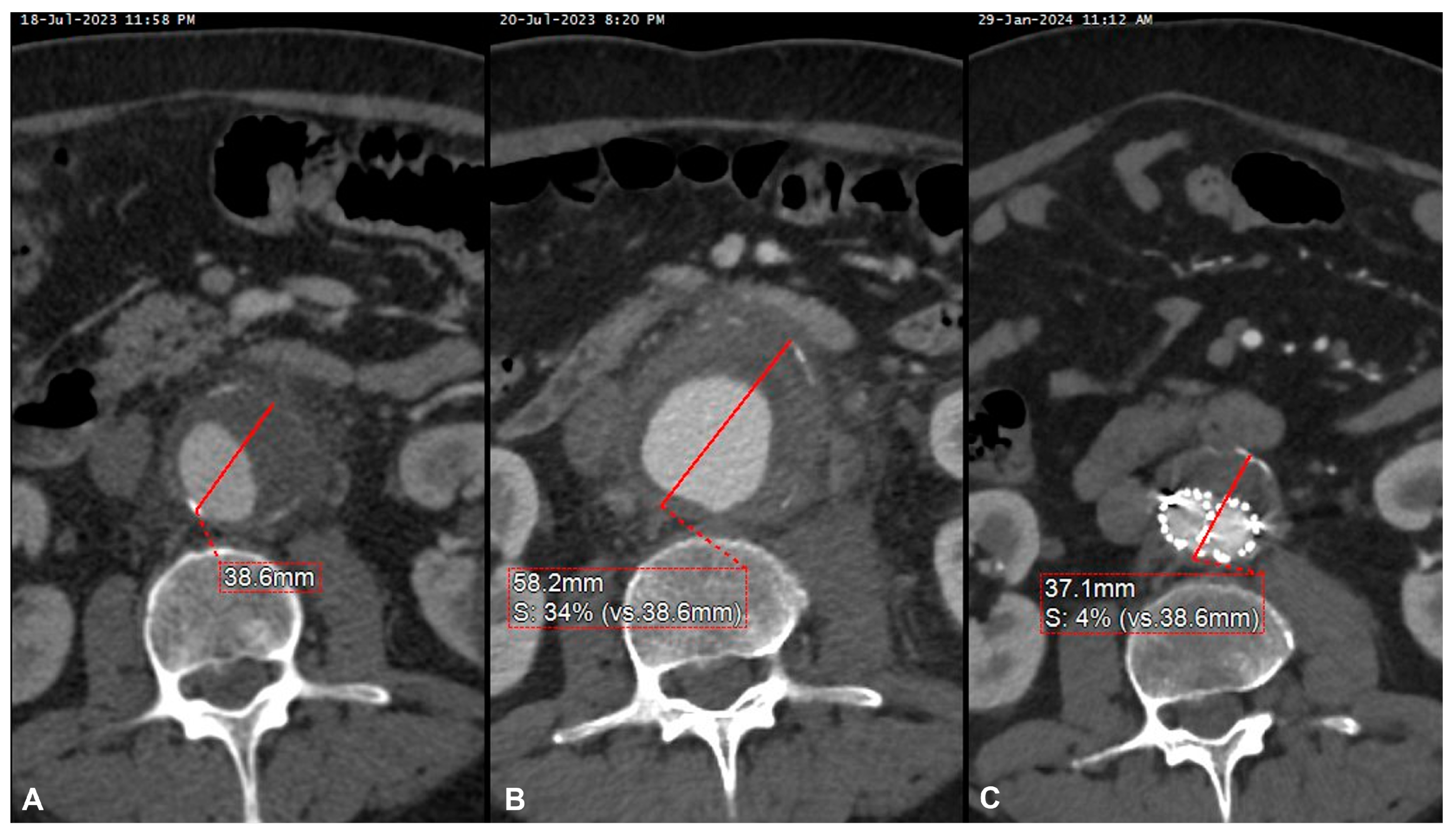 Jcm 13 04669 g003 Jcm 13 04669 g003