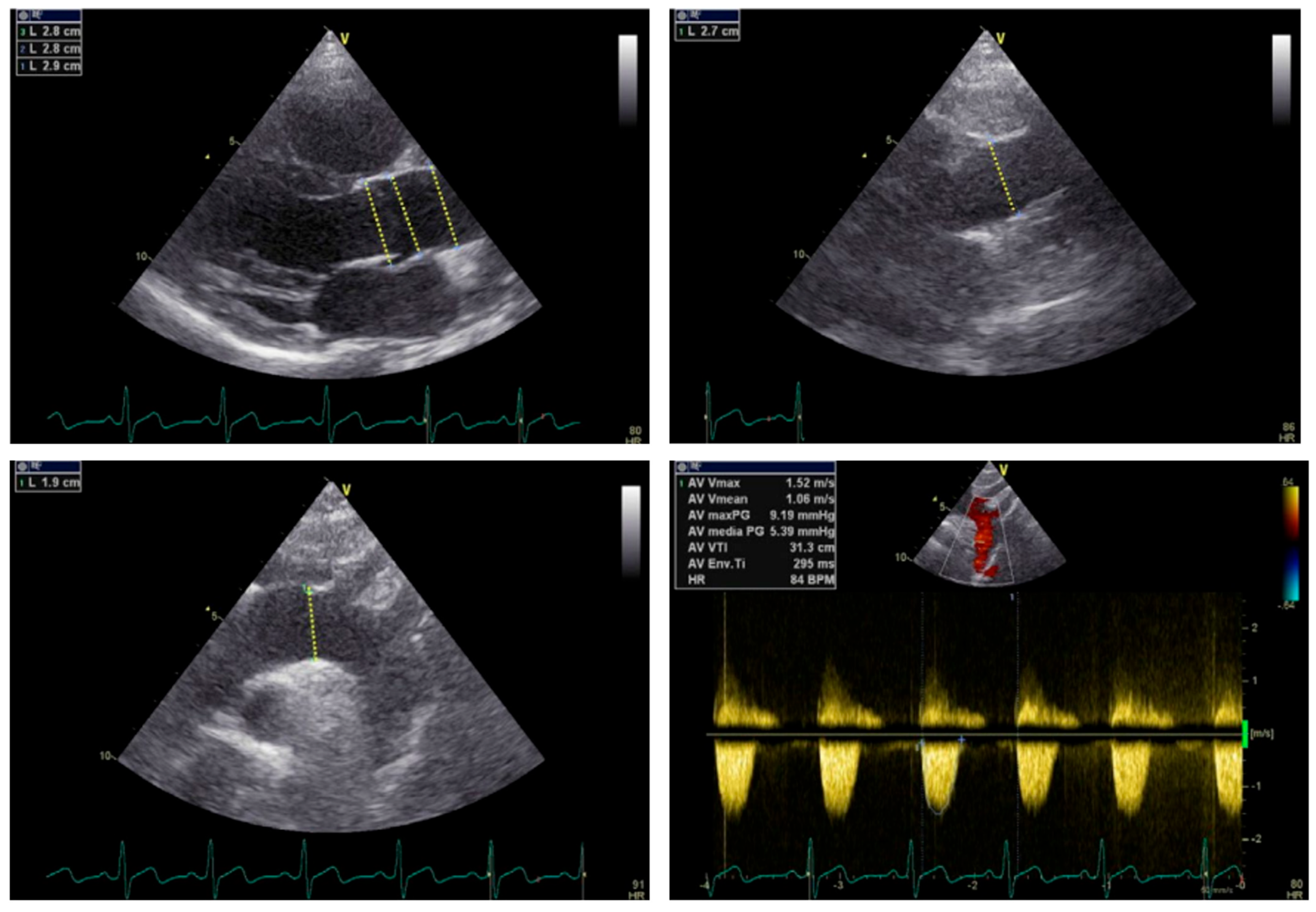 Jcm 13 04970 g004 Jcm 13 04970 g004