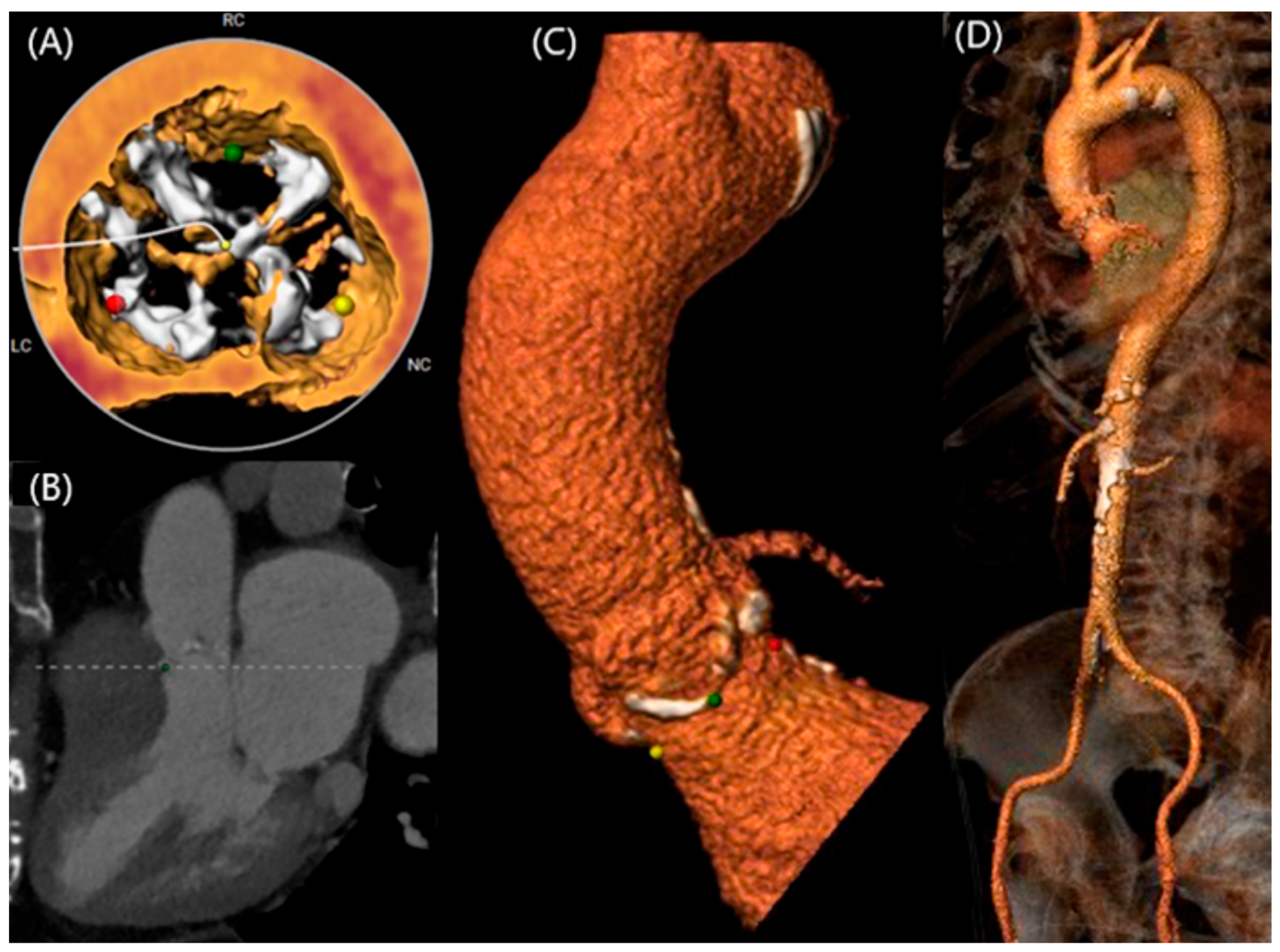 Jcm 13 04970 g005 Jcm 13 04970 g005