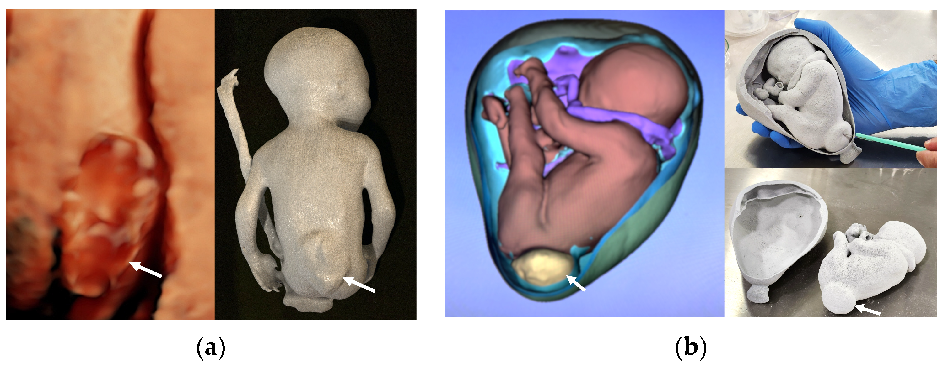 Jcm 13 04999 g002 Jcm 13 04999 g002