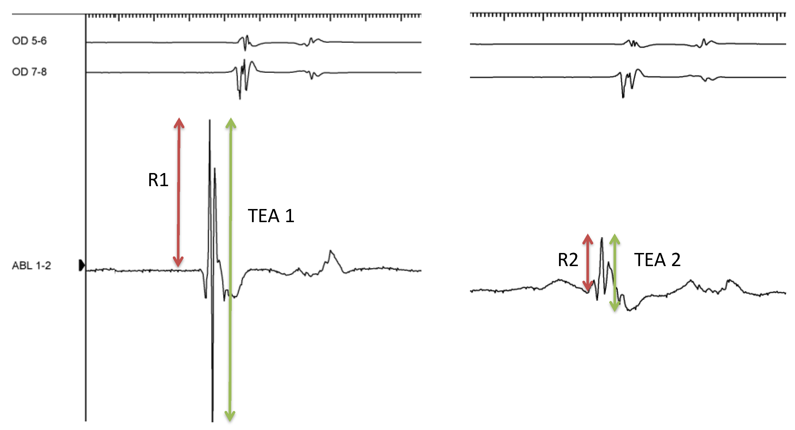 Jcm 13 05153 g002 Jcm 13 05153 g002