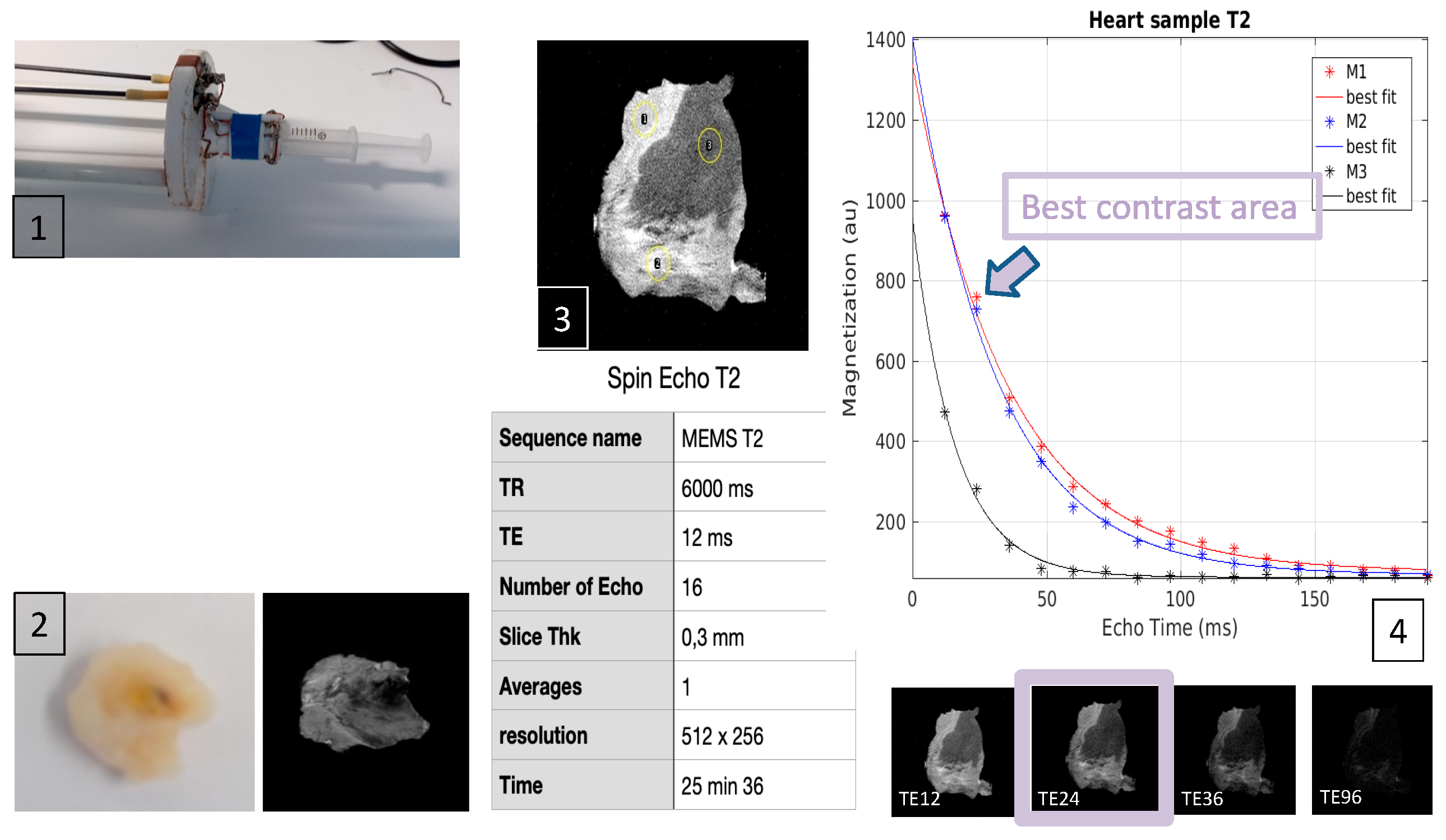 Jcm 13 05153 g004 Jcm 13 05153 g004