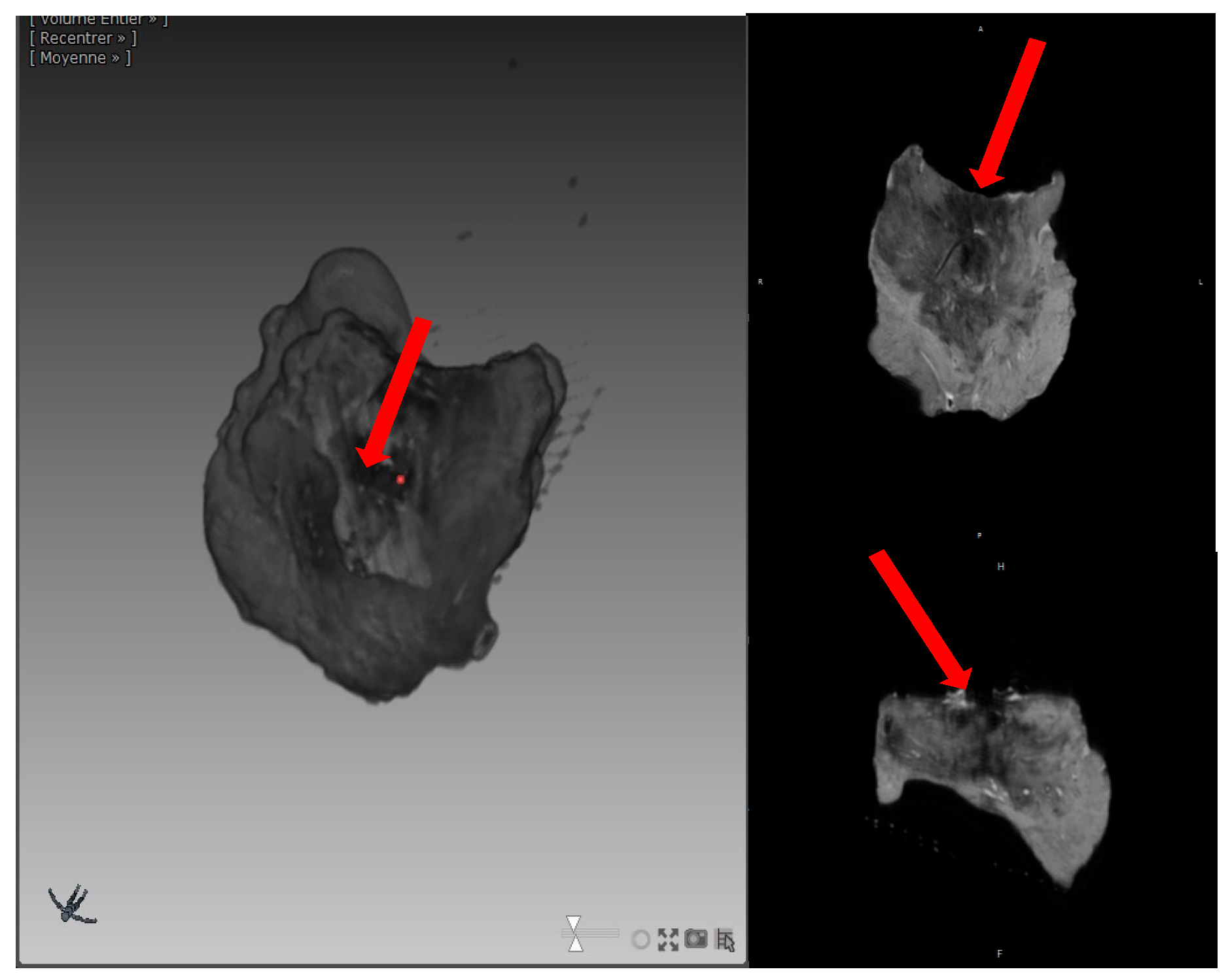 Jcm 13 05153 g006 Jcm 13 05153 g006