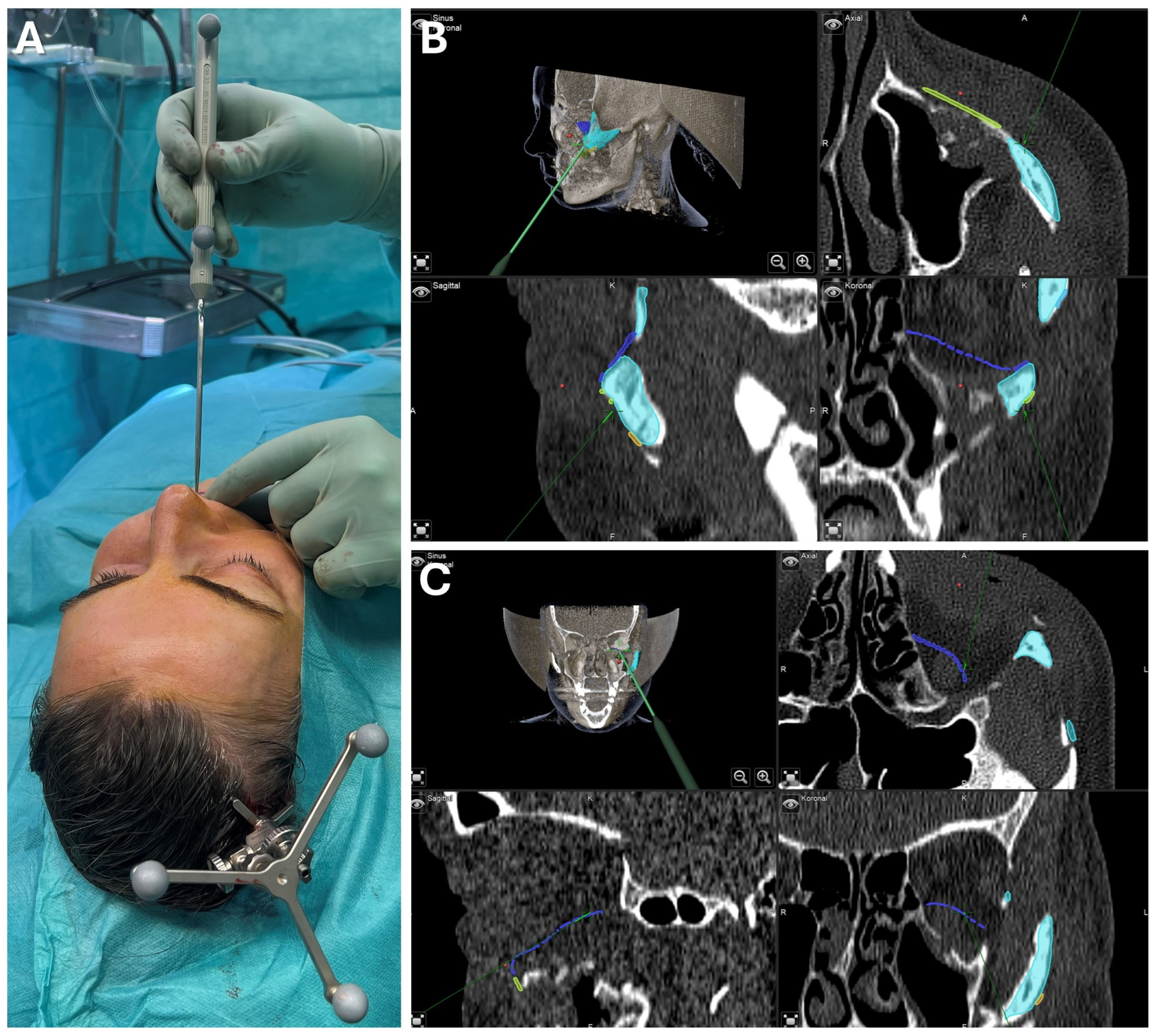 Jcm 13 05196 g008 Jcm 13 05196 g008