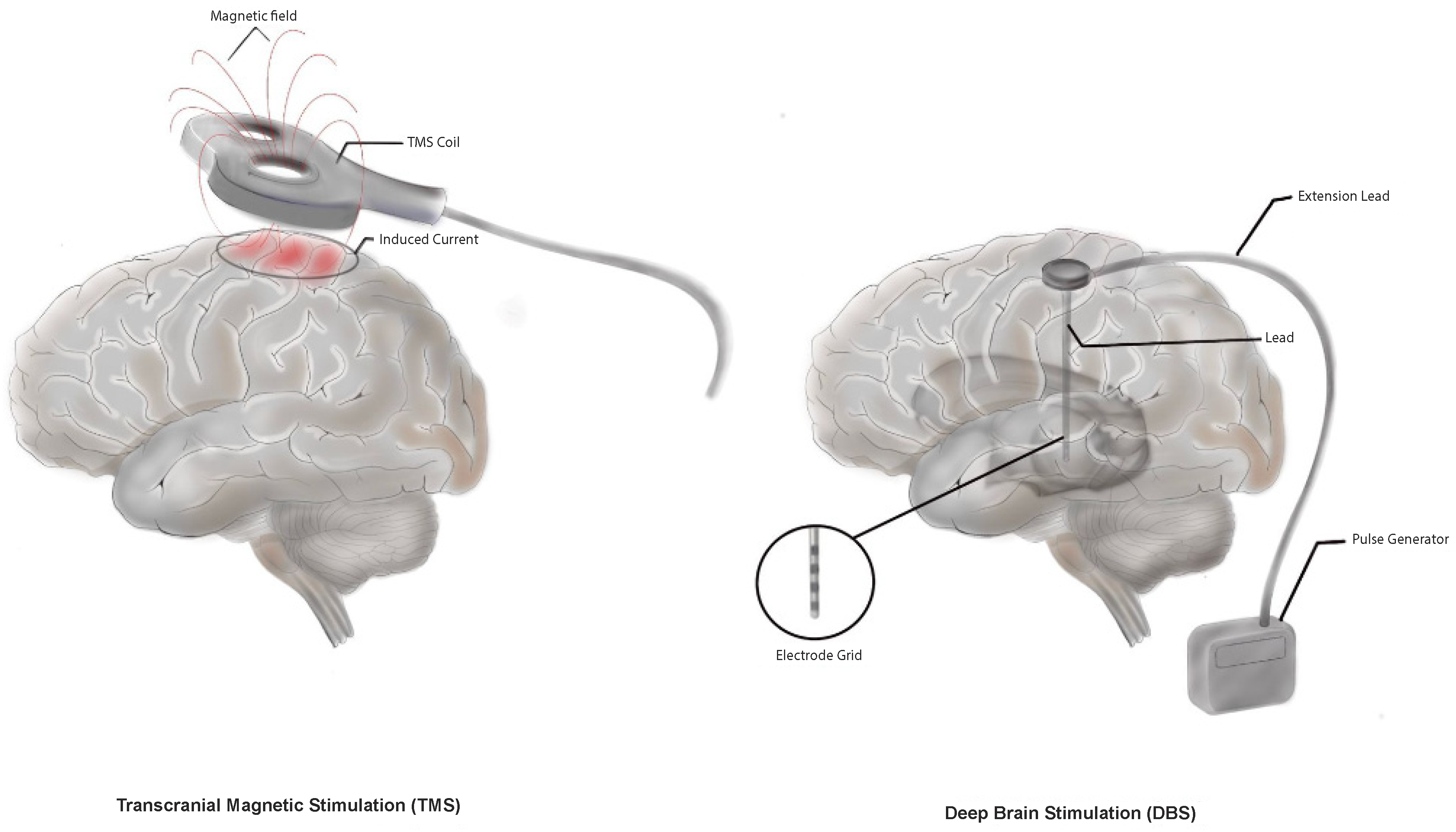 Jcm 13 05377 g001 Jcm 13 05377 g001
