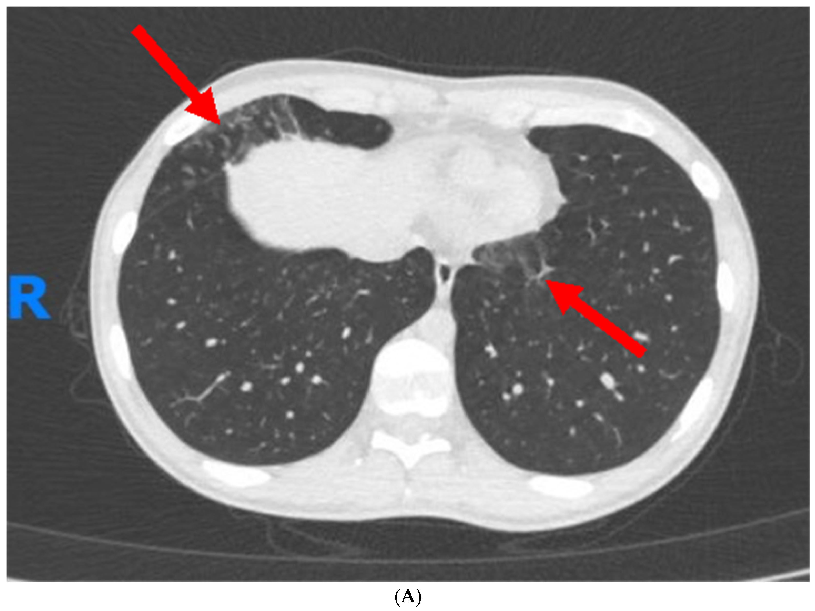Jcm 13 05401 g001a Jcm 13 05401 g001a